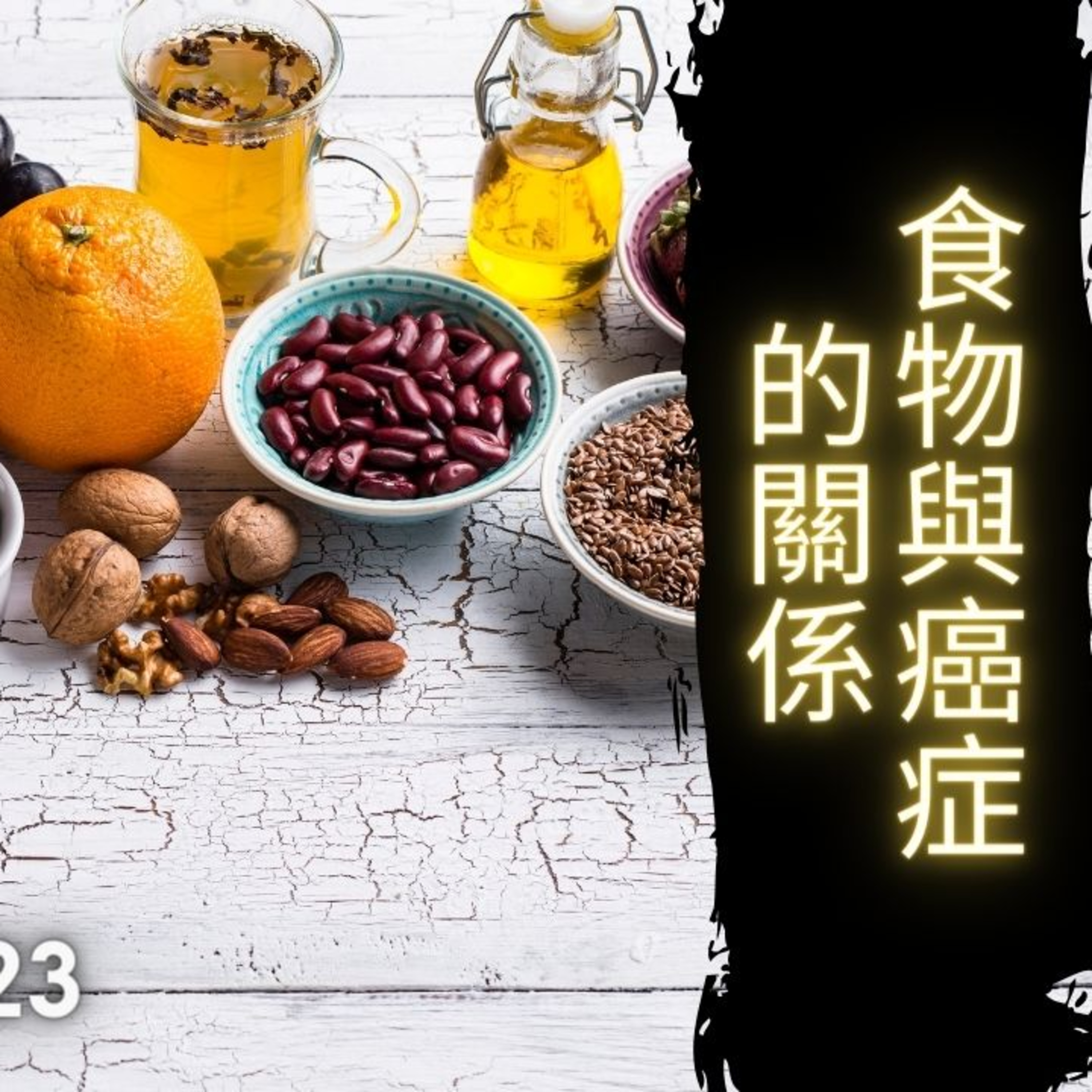 《醫學新世代》:10.15.2023 食物與癌症的關係 Food and Cancer - Arthur Lo AM1430