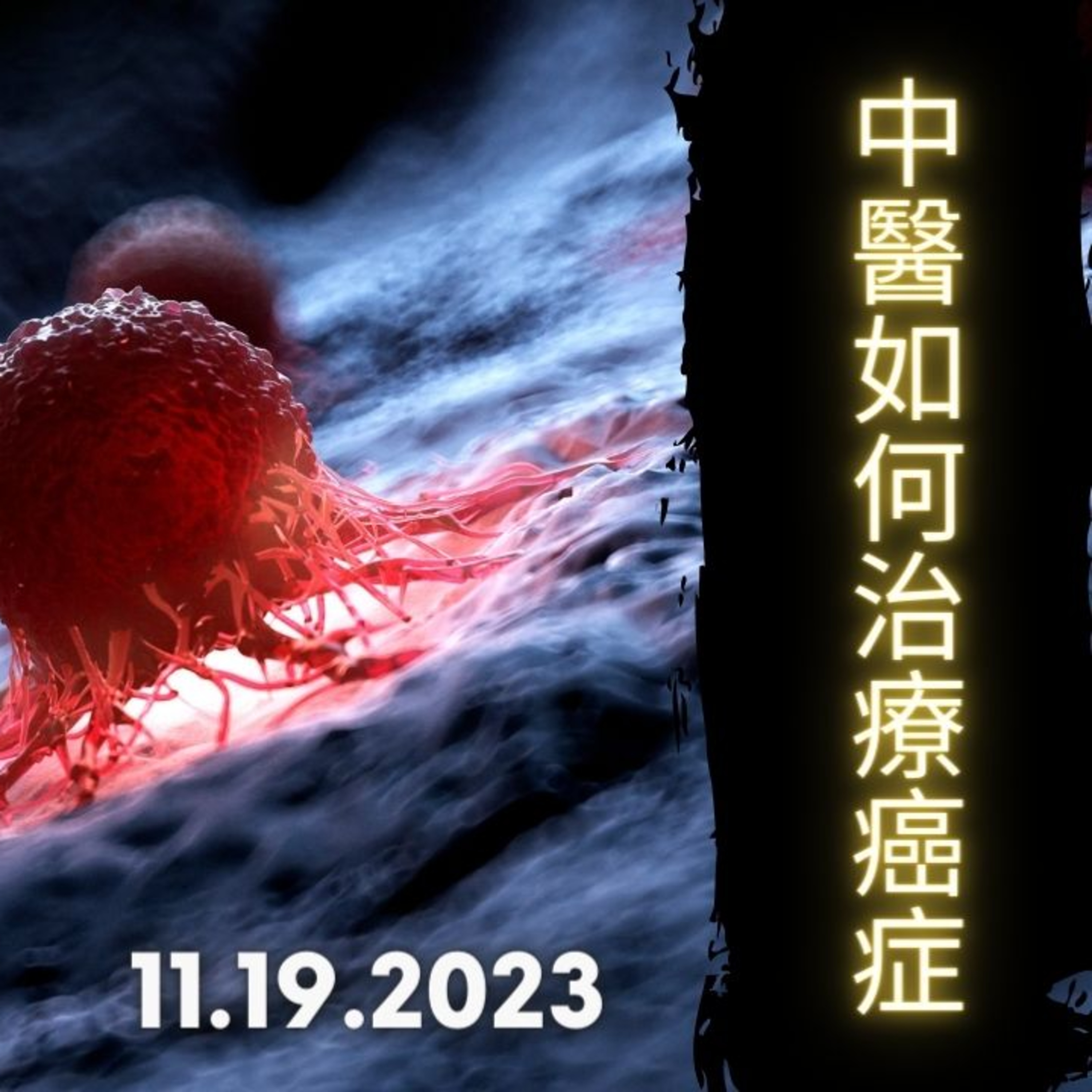 《醫學新世代》 11.19.2023 - 中醫如何治療癌症 Cancer and Traditional Chinese Medicine - Arthur Lo AM1430