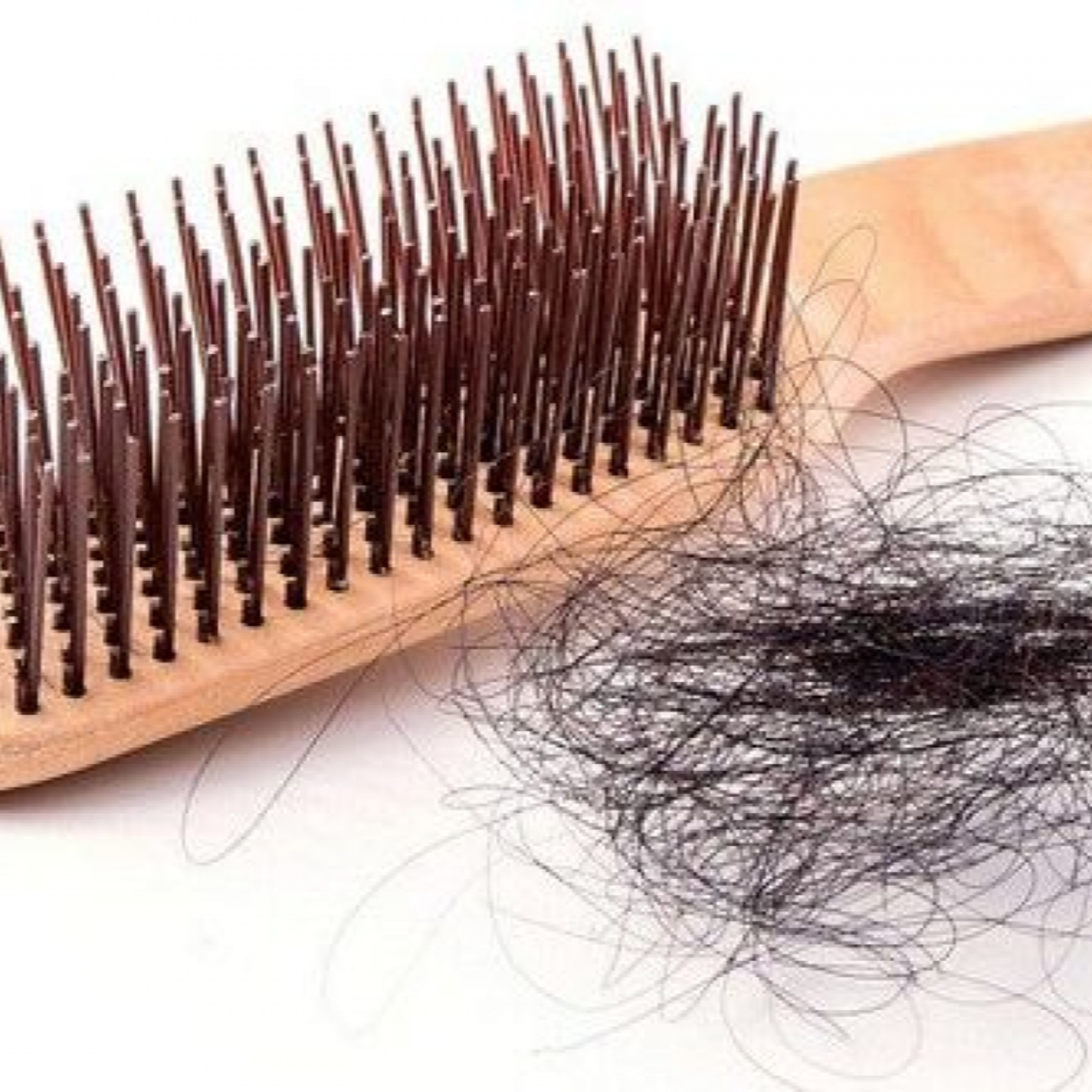 360 độ Sức khỏe - Rụng tóc, hói đầu: Từ dấu hiệu bất thường đến giải pháp điều trị