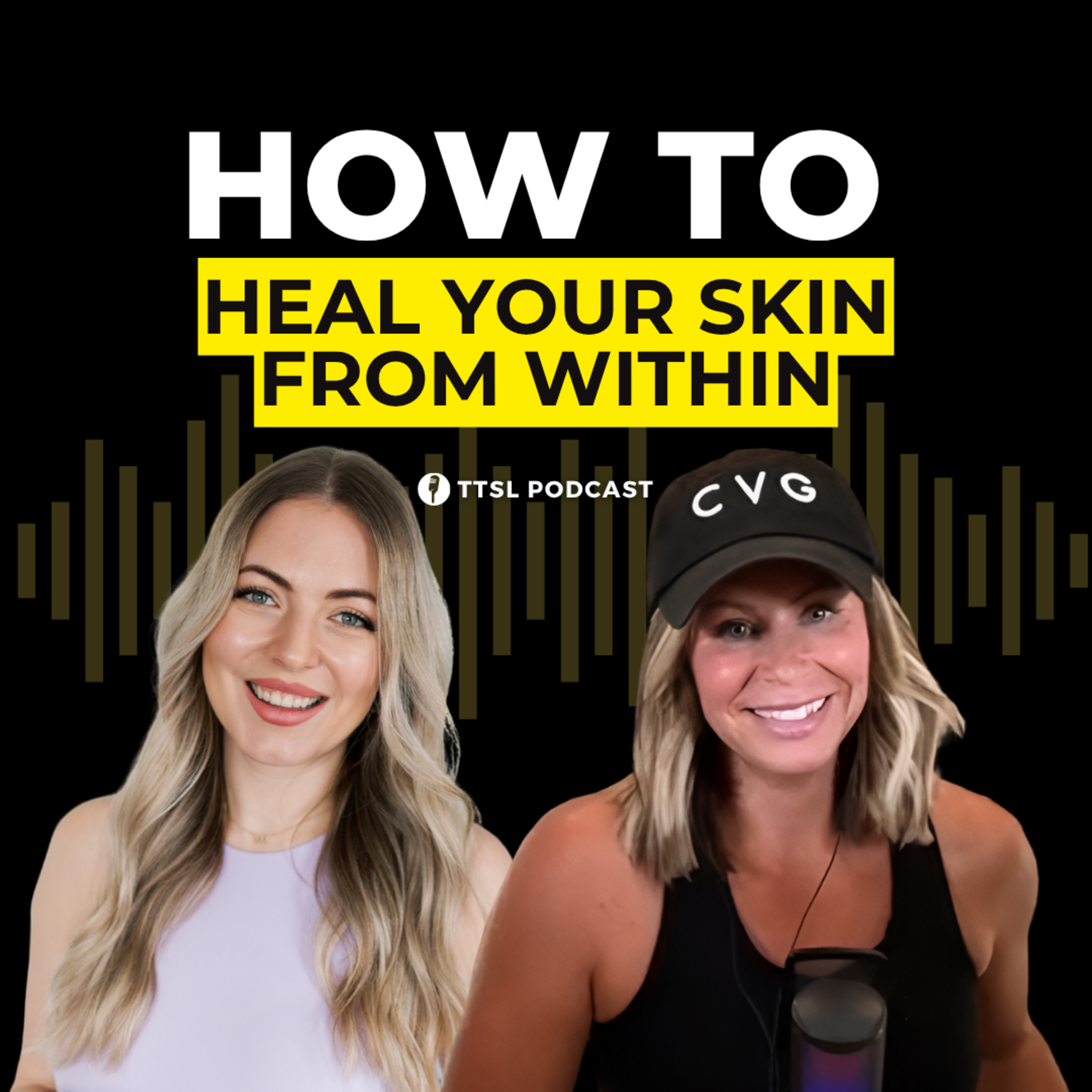 S12 EP27: How to Heal Your Skin from Within