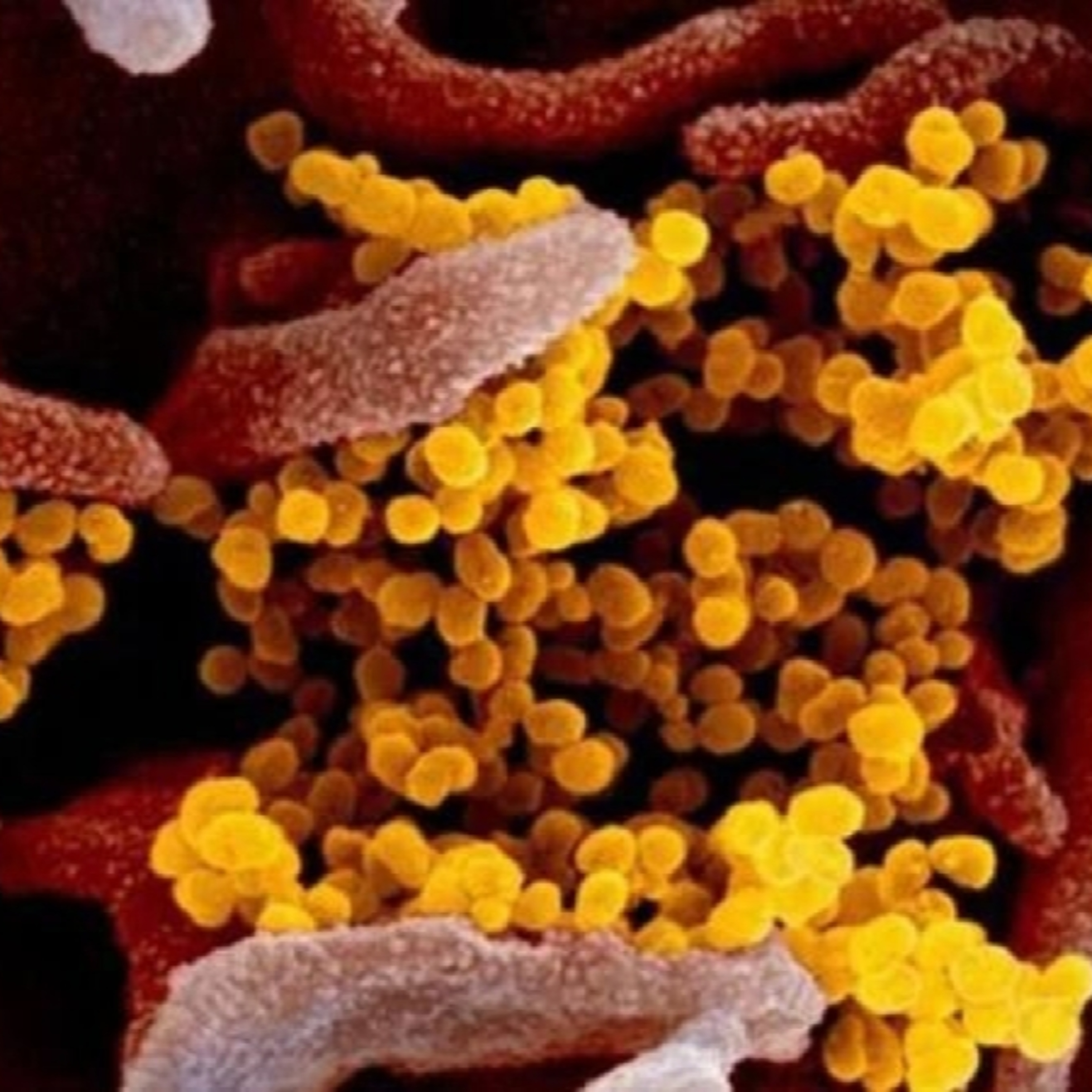 Thời sự 12h 29/3/2026: Bộ Y tế ra khuyến cáo về biến thể mới của SARS-CoV-2