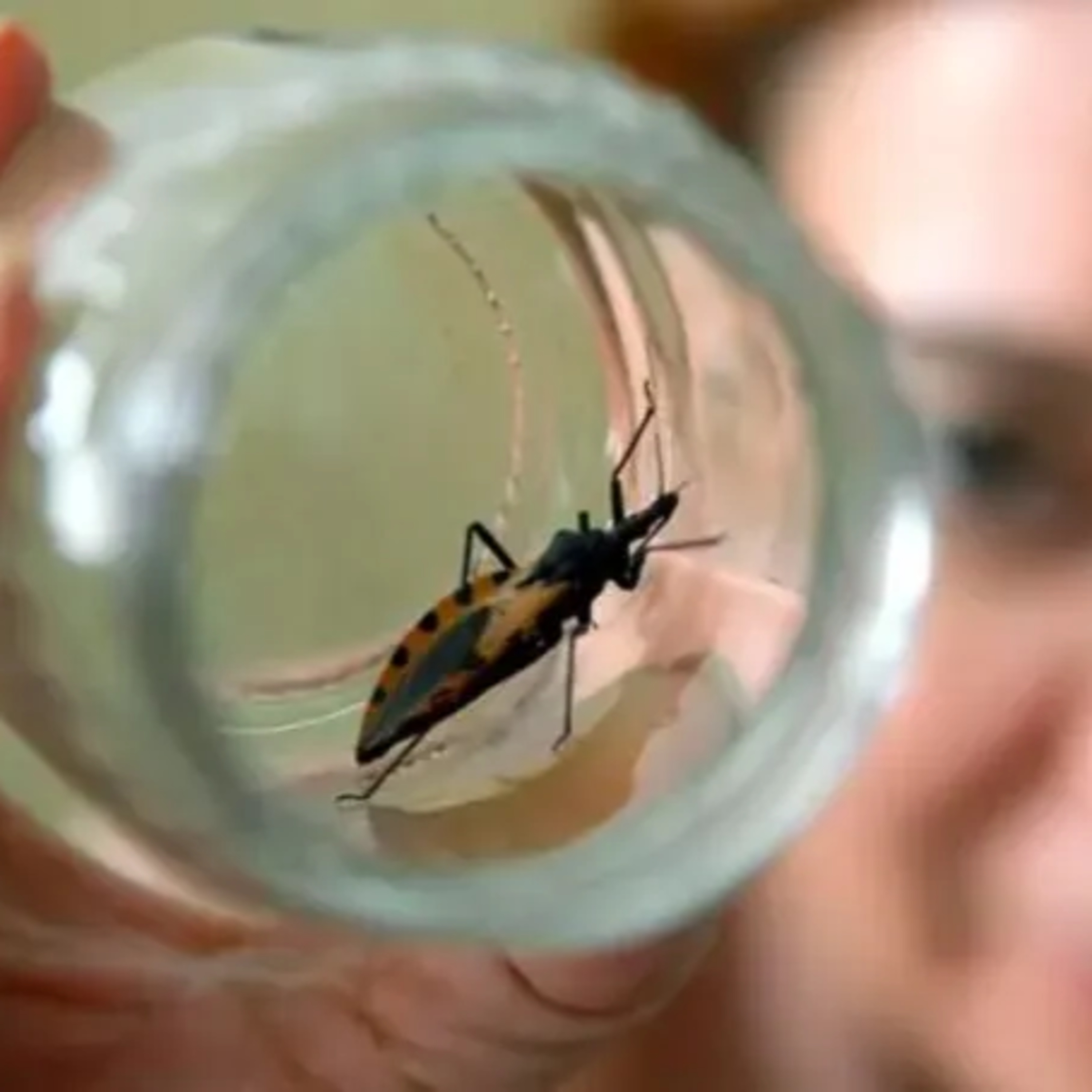 Chagas: Avances científicos desde Mendoza.