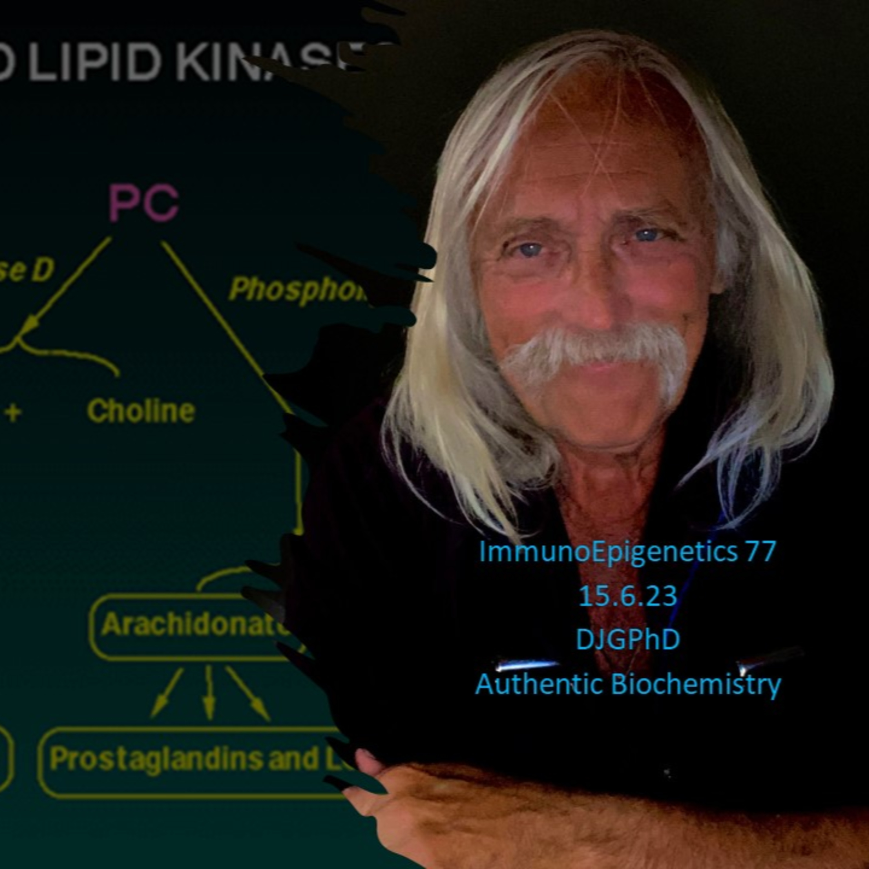 ImmunoEpigenetics77. T cell membrane phospholipase D mediated PA deprotonation as a biosensor for an electrostatic/hydrogen-bond signal transductionDJGPhD.15.6.23. Authentic Biochemistry Podcast.