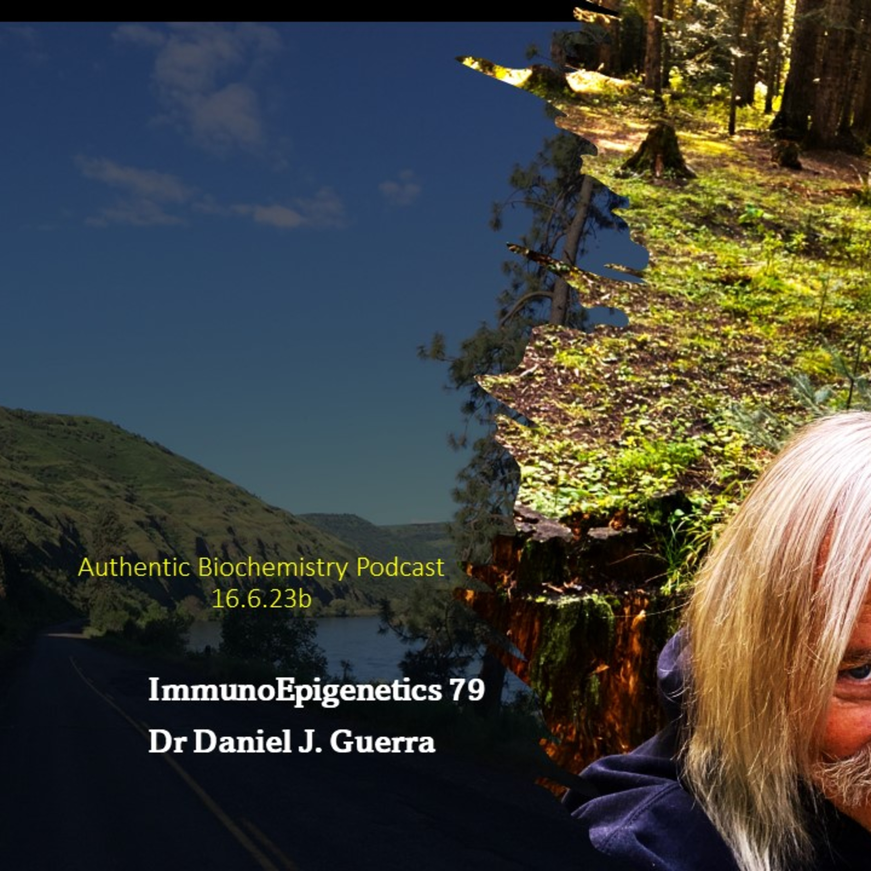 ImmunoEpigenetics79. T lymphocyte DPPA induced HSP27 deoligomerization-activating DGK-a associated anergy is linked to cancer cell proliferation phenotypes. DJGPhD.16.6.23b Authentic Biochemistry
