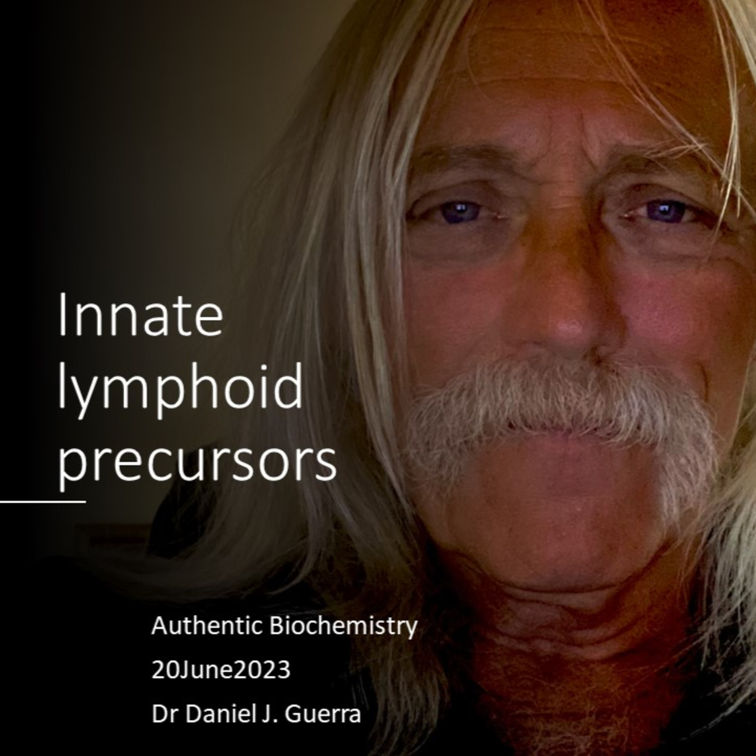 ImmunoEpigenetics 81.Innate lymphoid cells lack antigen receptors and are differentiated into multiple linneages via epigenetic priming of nucleosomal regions proximal to cell-specific TF's.DJGPhD.