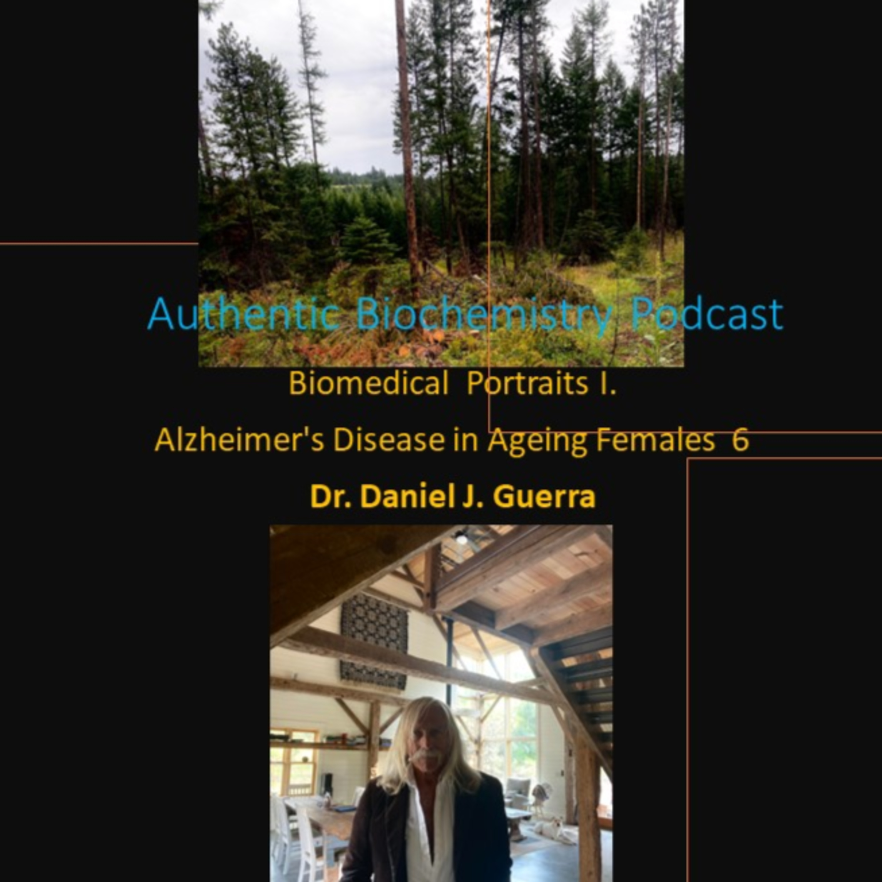 BioMedical Portraits I. Chapter 6. Complications of female cerebrovascular trauma and obesity-linked Type2 Diabetes in post-menopausal estrogen therapeutics for prophylactic treatment of subsequent AD