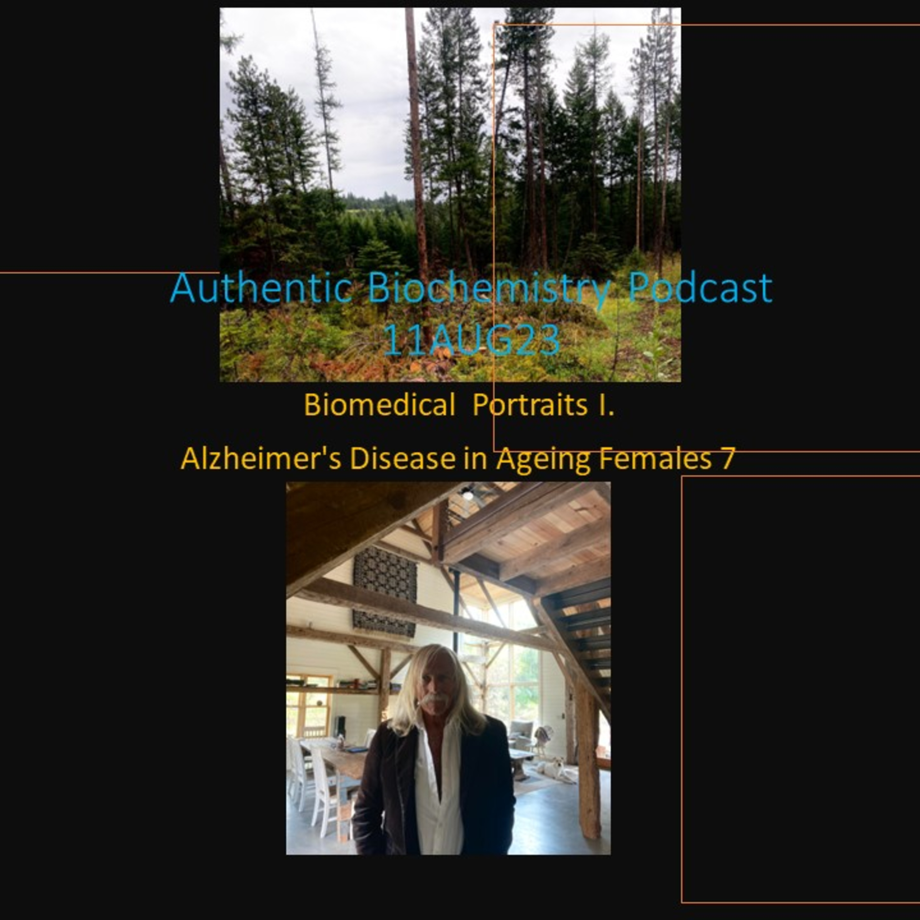 BioMedical Portraits I. Chapter 7. Hormone replacement and the general distinctions of cholesterol homeostasis, metabolic zonation, hydroxysterols and estrogen receptor heterogeneity in female AD.