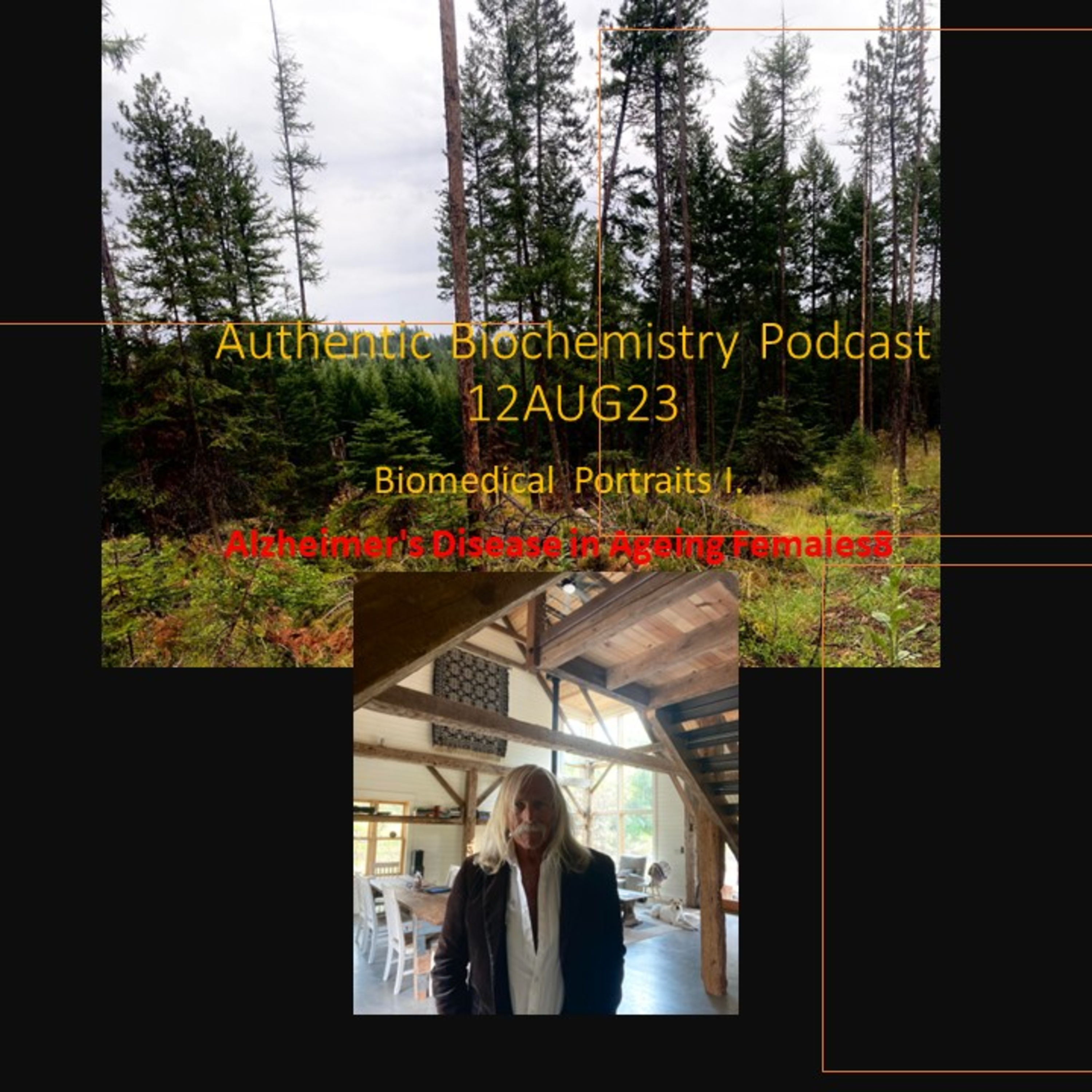 BioMedical Portrait I. Chapter 8. Female AD progression post-menopausal severity is a complex pathobiochemical event that may involve cholesterol and steroid metabolism in the CNS and periphery.DJGPhD