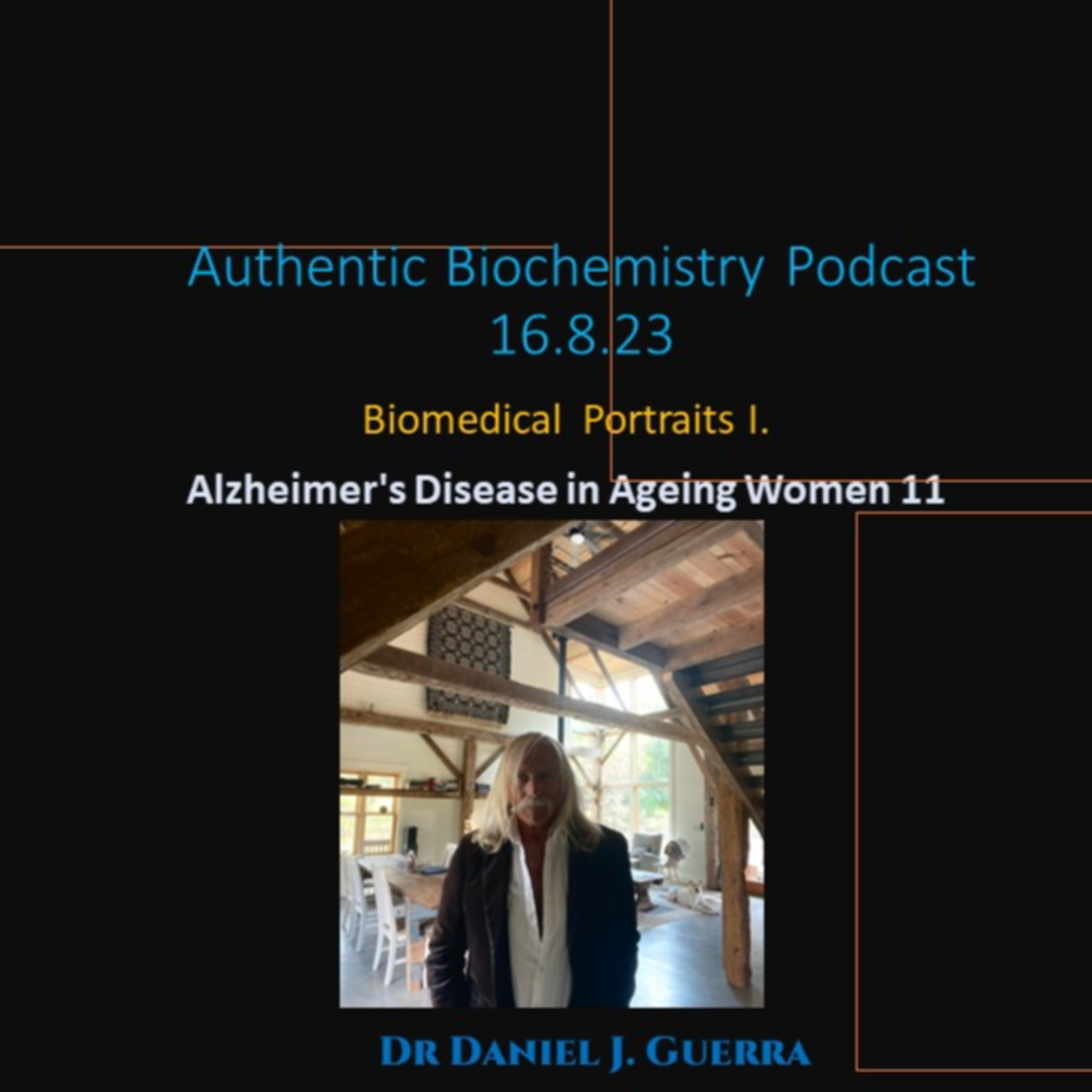 BioMedical Portraits I. [11]. Phospholipid and lipoprotein lipase activity may link to oxy-cholesterol/PL transport mechanisms to generate post-menopausal AD. DJGPhD.16.8.23. Authentic Biochemistry