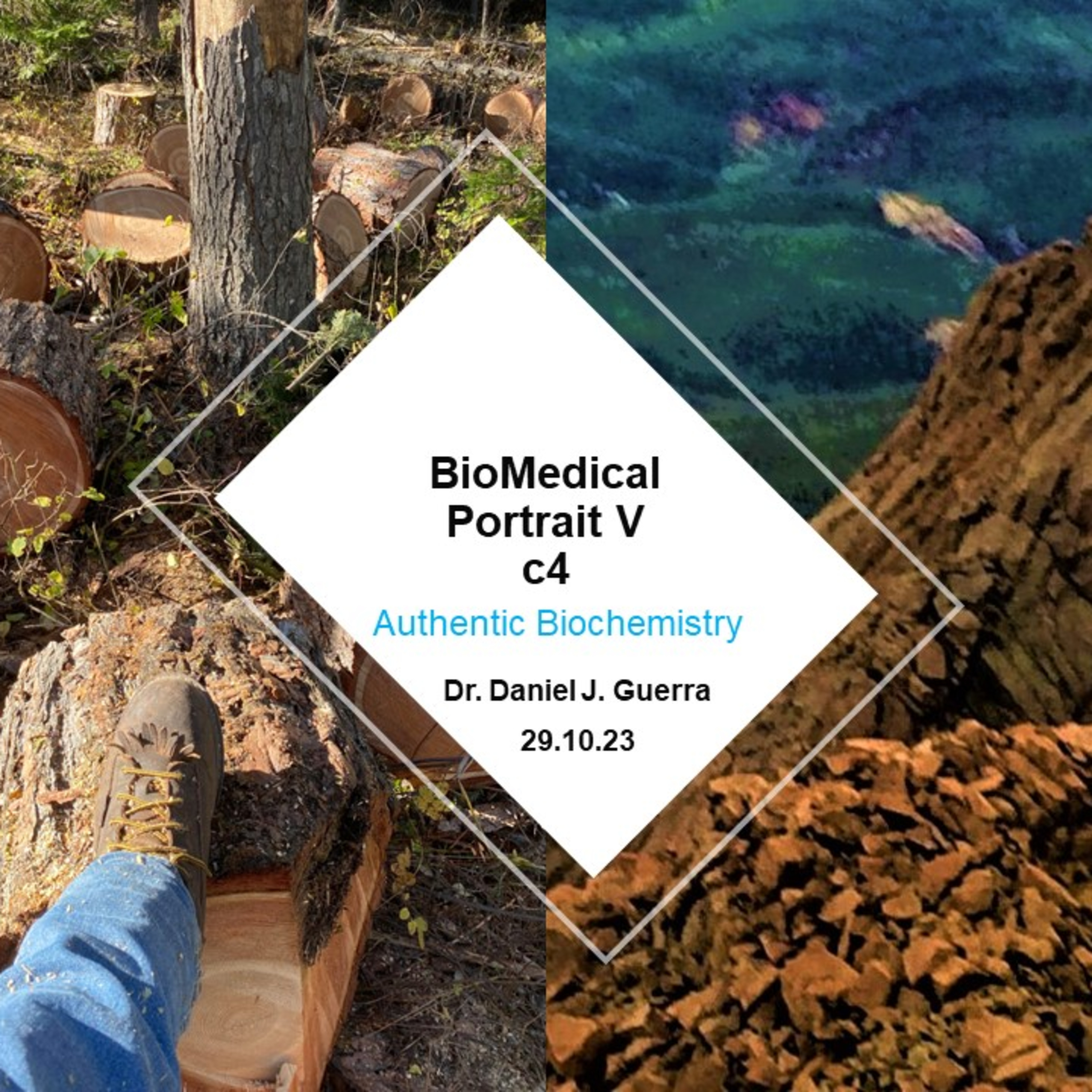 BioMedical Portrait Vc4 Two component signal system pathogenic bacterial responses to host immunity and the gigipain cysteine protease opposing serum secretory IgA mediated phagocyte activation.DJGPhD