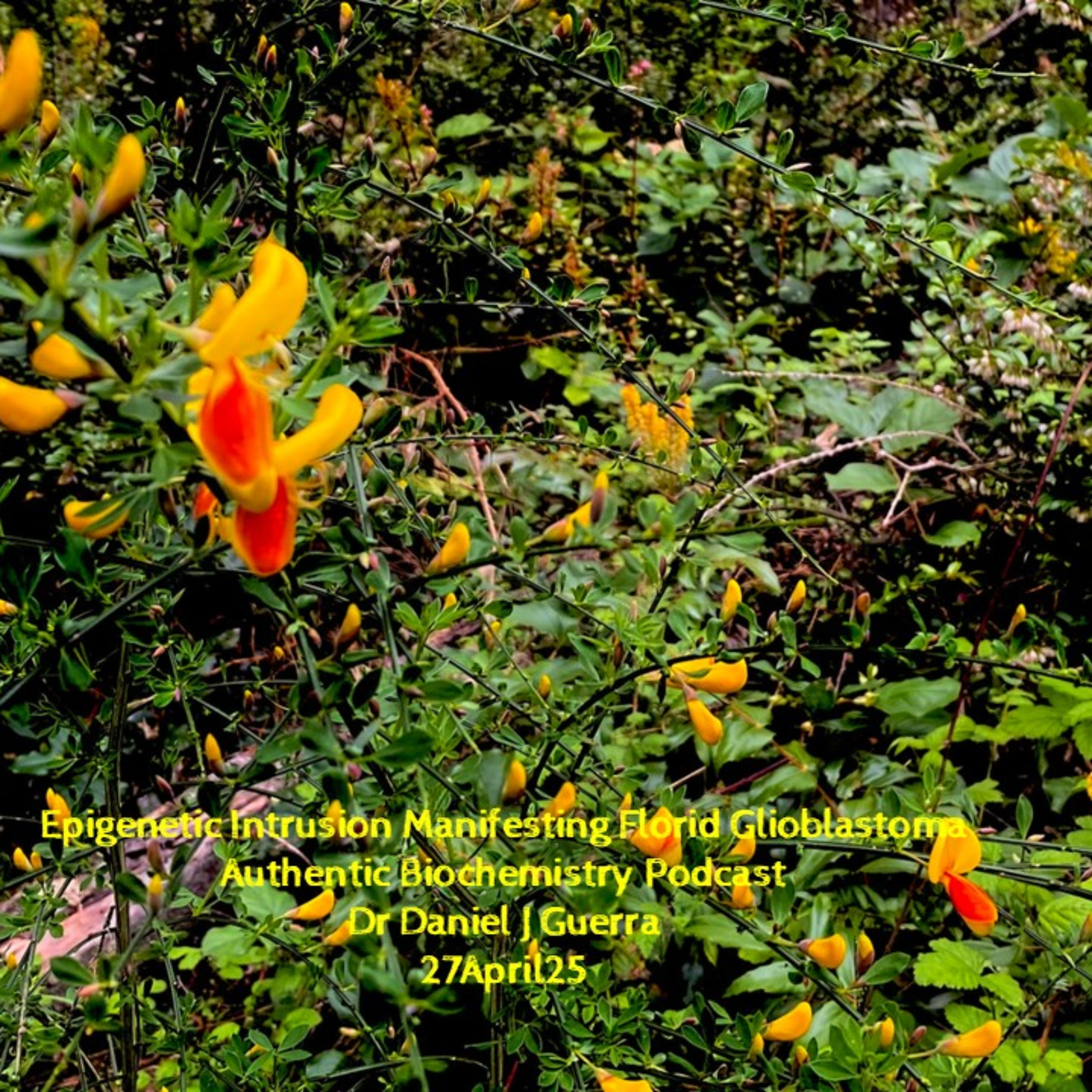 Epigenetic Intrusion Manifesting Florid Glioblastoma. Authentic Biochemistry Podcast Dr Daniel J Guerra 27April25