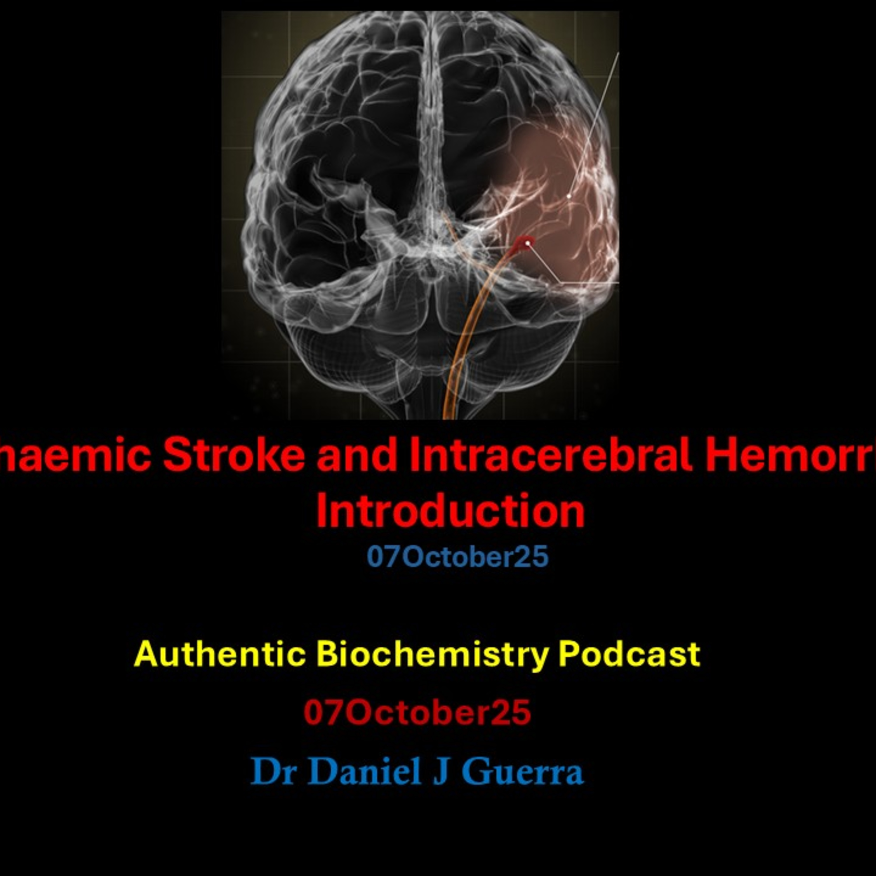 Ischaemic Stroke and Intracerebral HemorrhageIntroduction 07October25.Authentic Biochemistry Podcast 07October25 Dr Daniel J Guerra