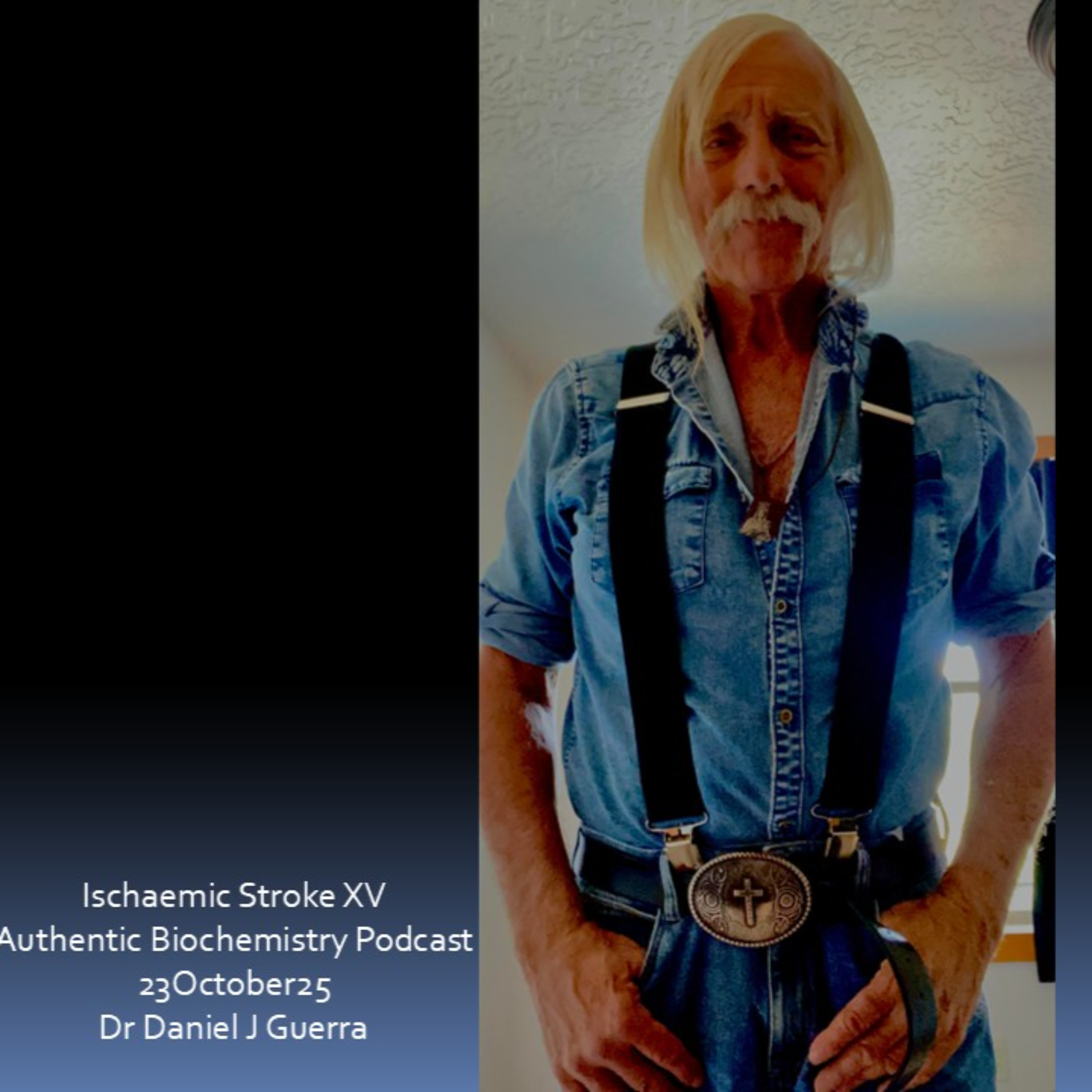 Ischaemic Stroke XV Authentic Biochemistry Podcast 23October25 Dr Daniel J Guerra