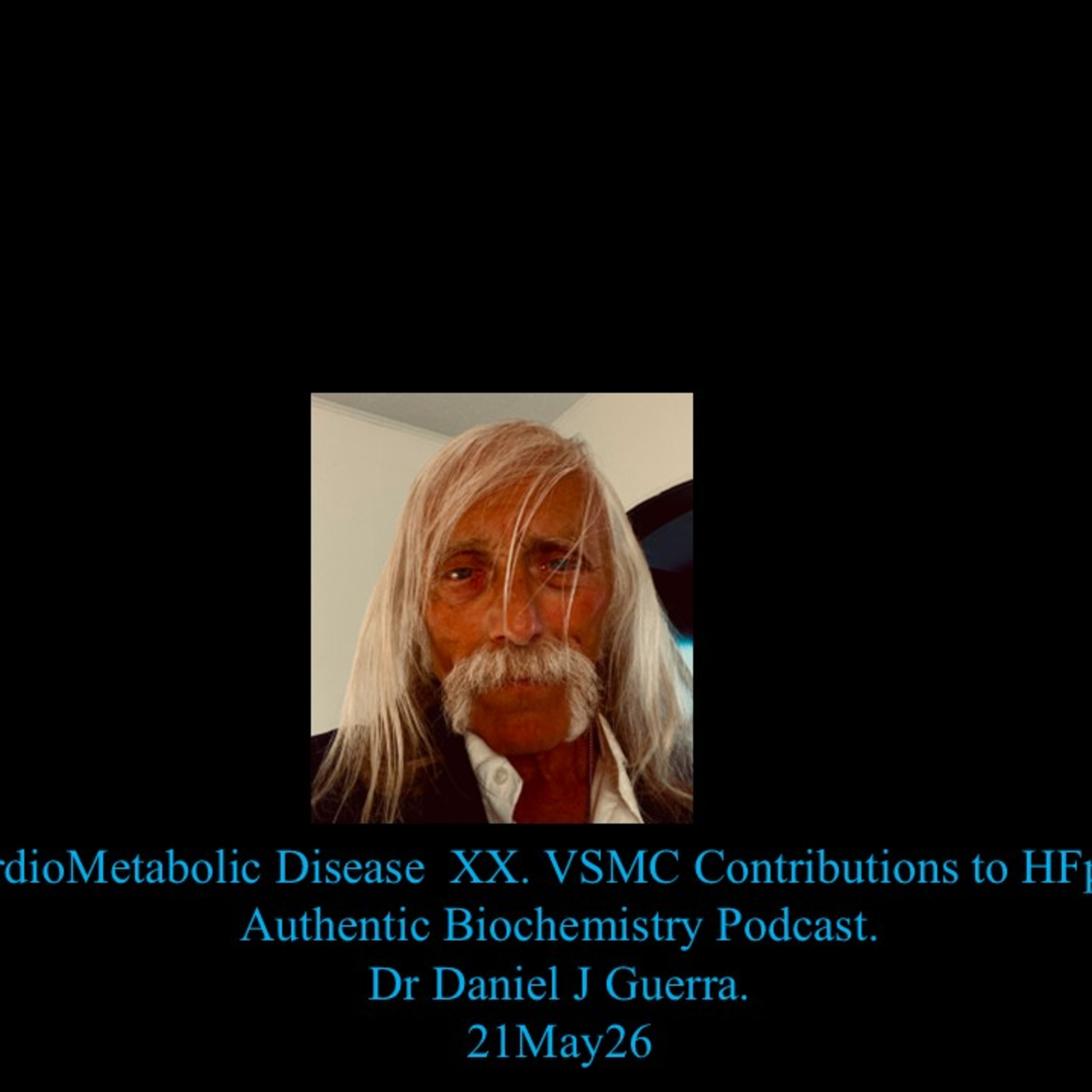 CardioMetabolic Disease XX. VSMC Contributions to HFpEF. Authentic Biochemistry Podcast. Dr Daniel J Guerra. 21May26