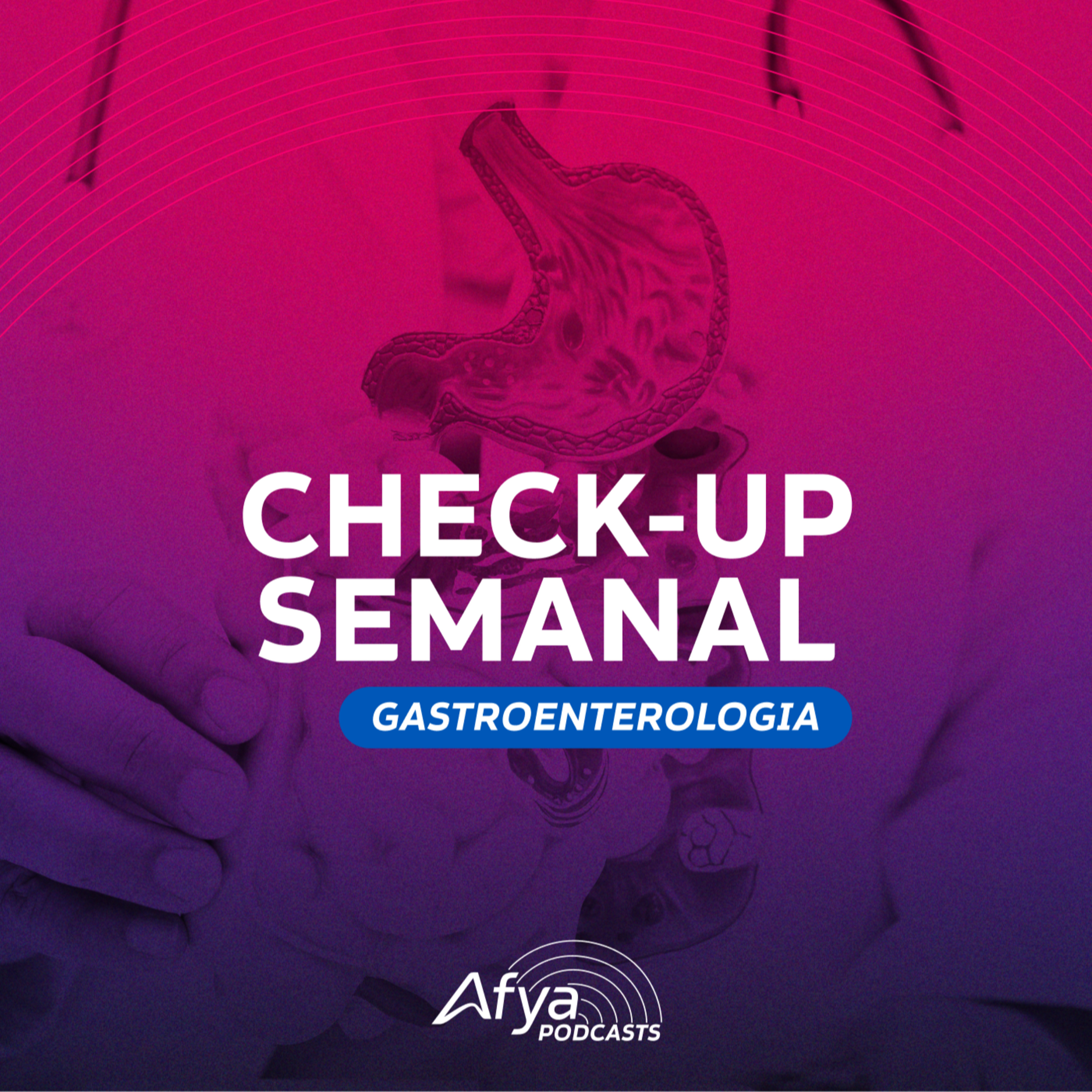 Check-up Semanal #Gastroenterologia: profilaxia de PBE, diarreia, SGIO e mais!