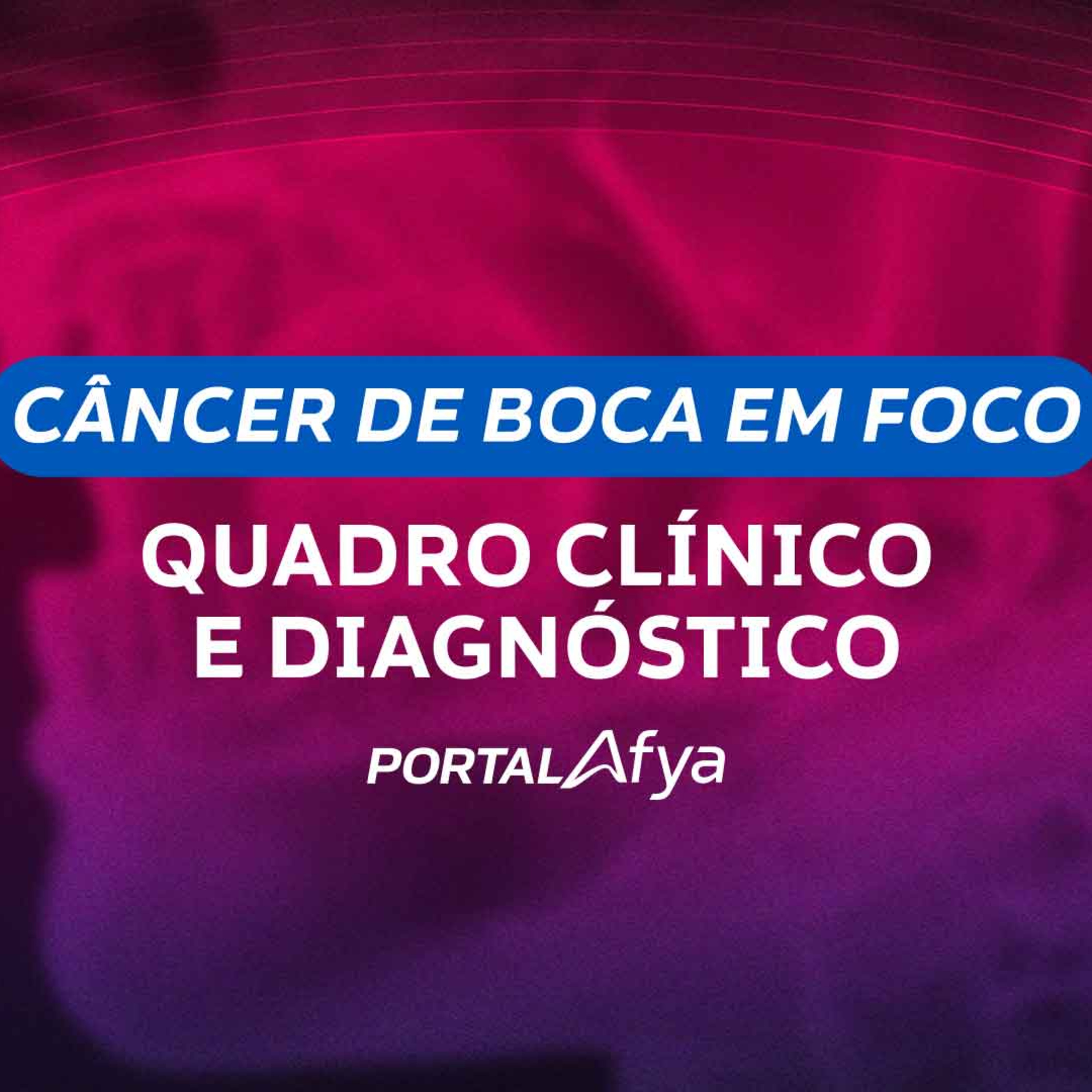 Câncer de boca em Foco: Quadro clínico e diagnóstico episode artwork