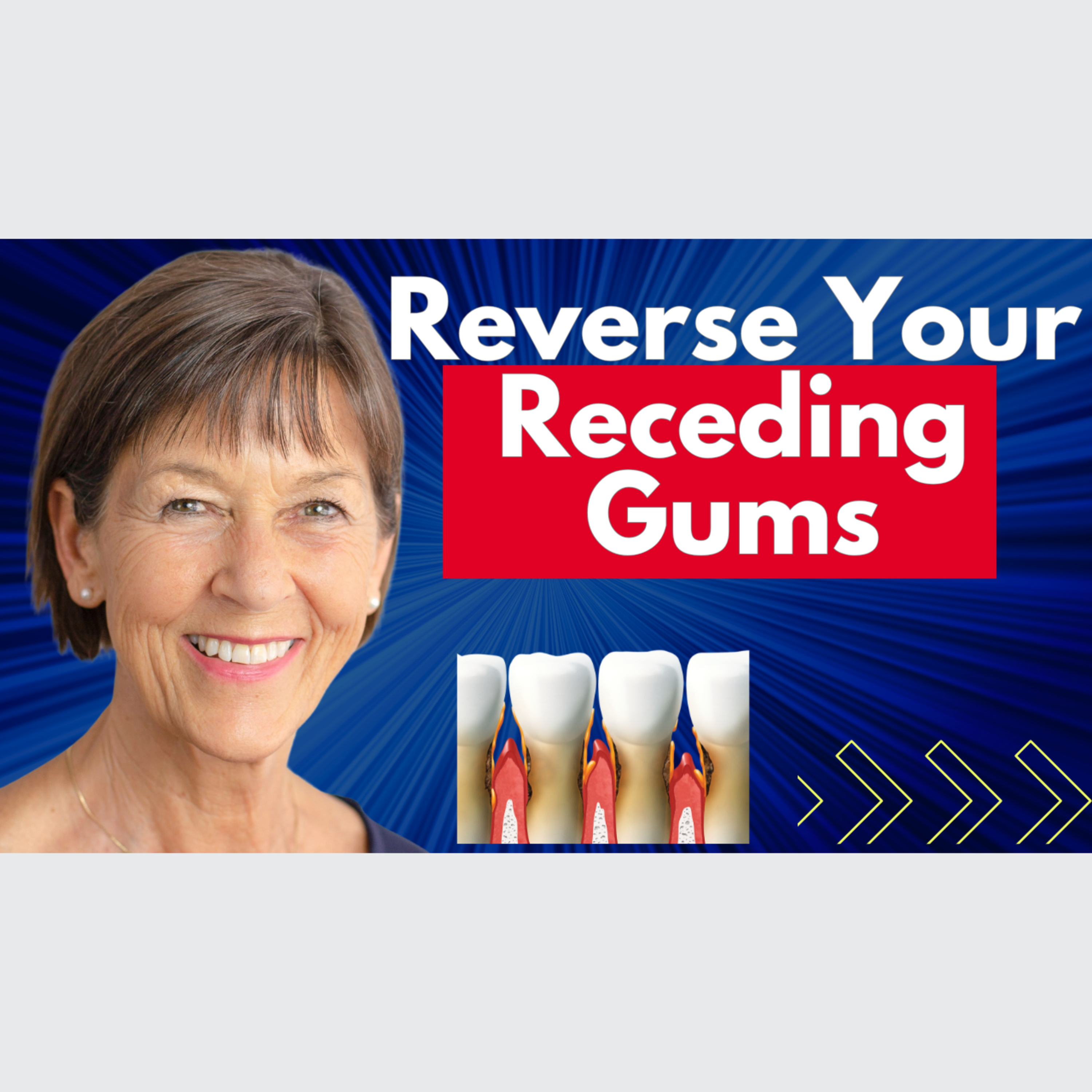 Reverse Your Receding Gums & Improve Oral Health | Dr Ellie Phillips Interview episode artwork