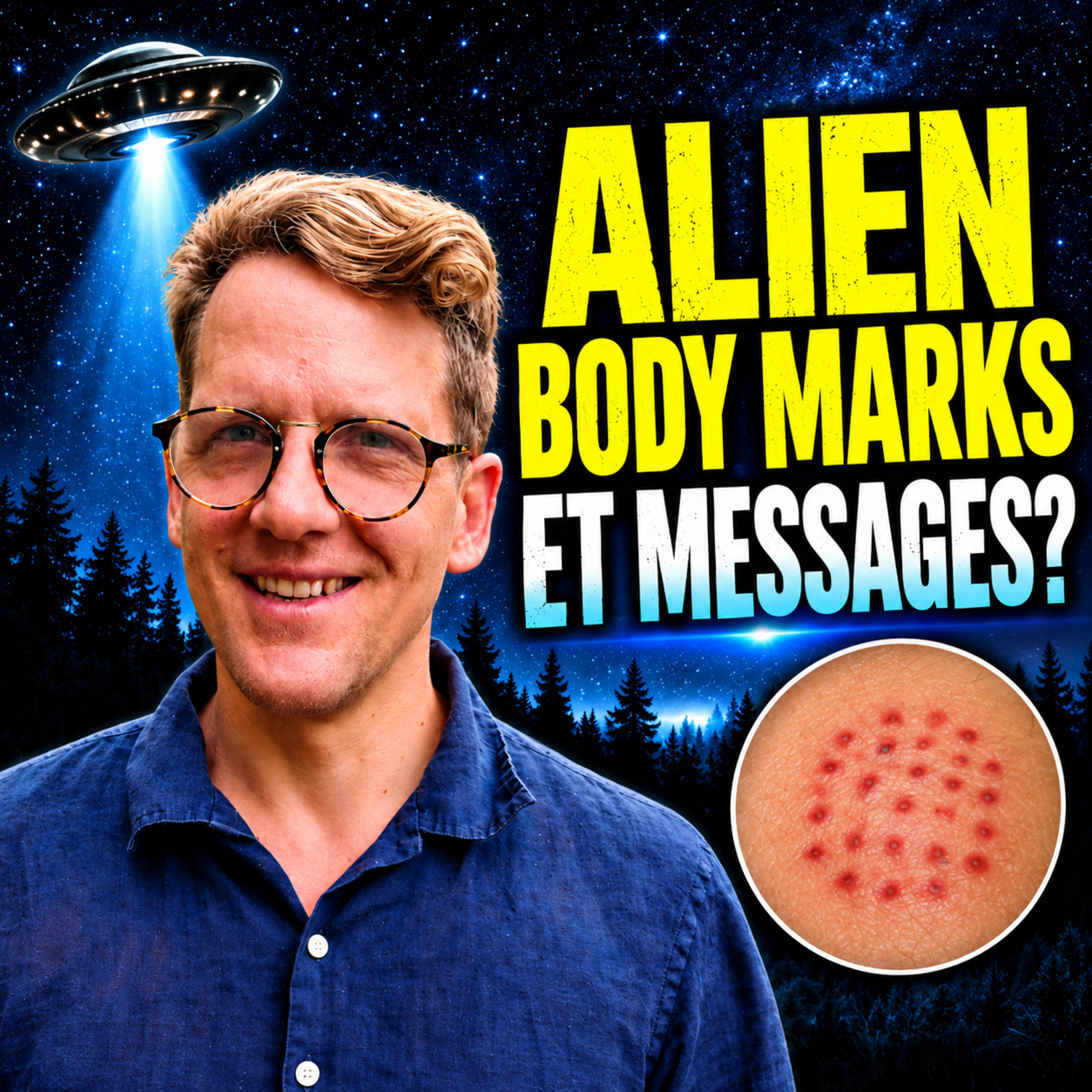 Alien Body Marks Messages from Non-Human Intelligence