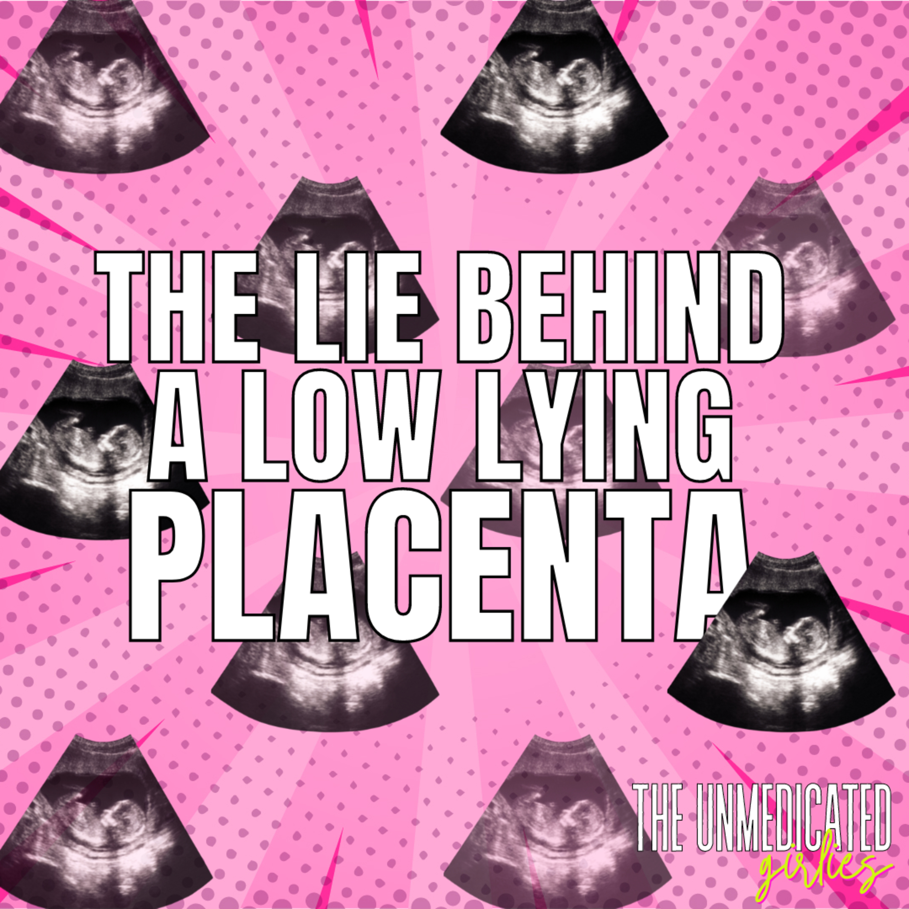 159 | The LIE behind a low lying placenta