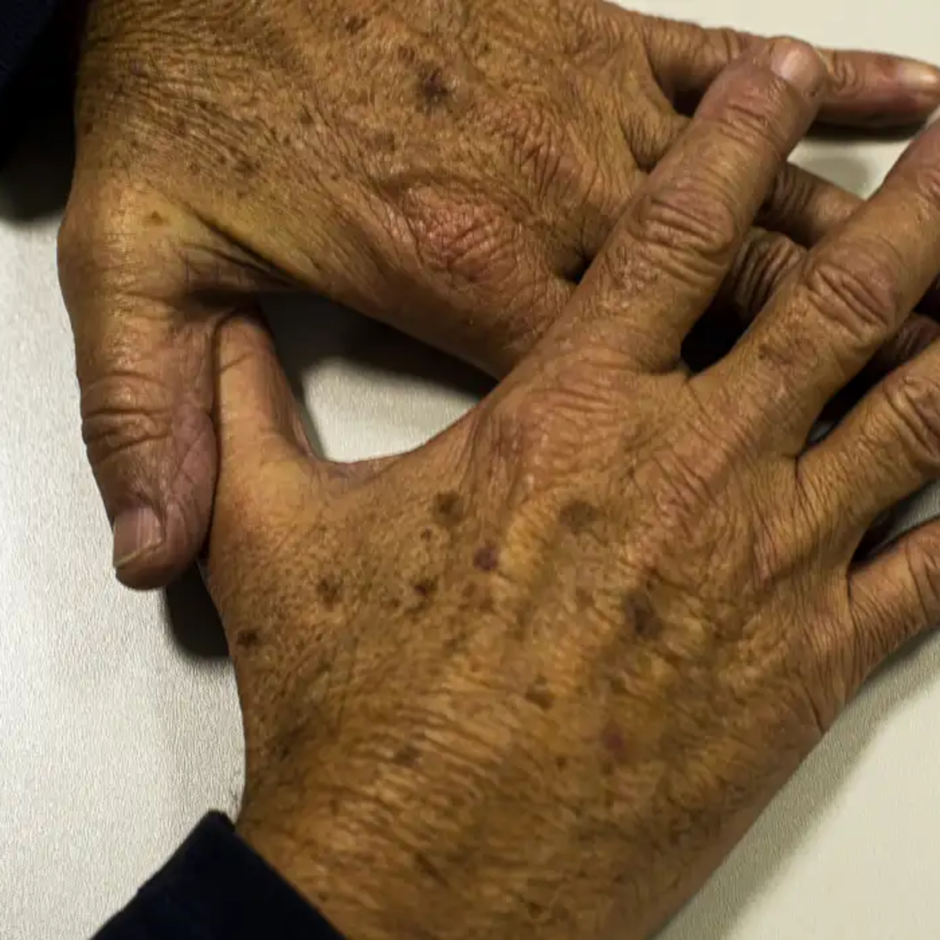 Brasil deve ter 781 mil novos casos de câncer por ano até 2028 episode artwork