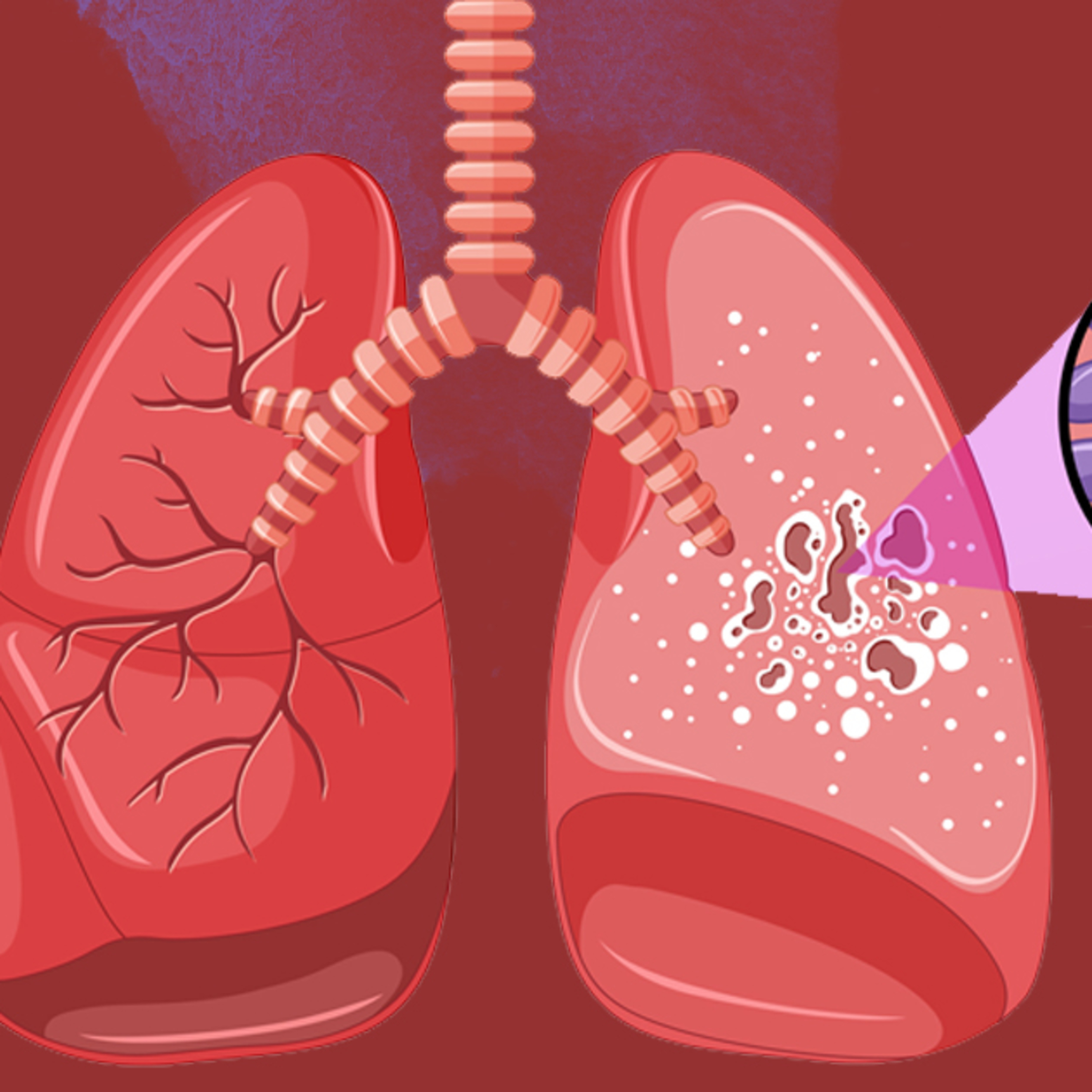 Tuberculose pode ser fatal; veja dicas de como se prevenir episode artwork
