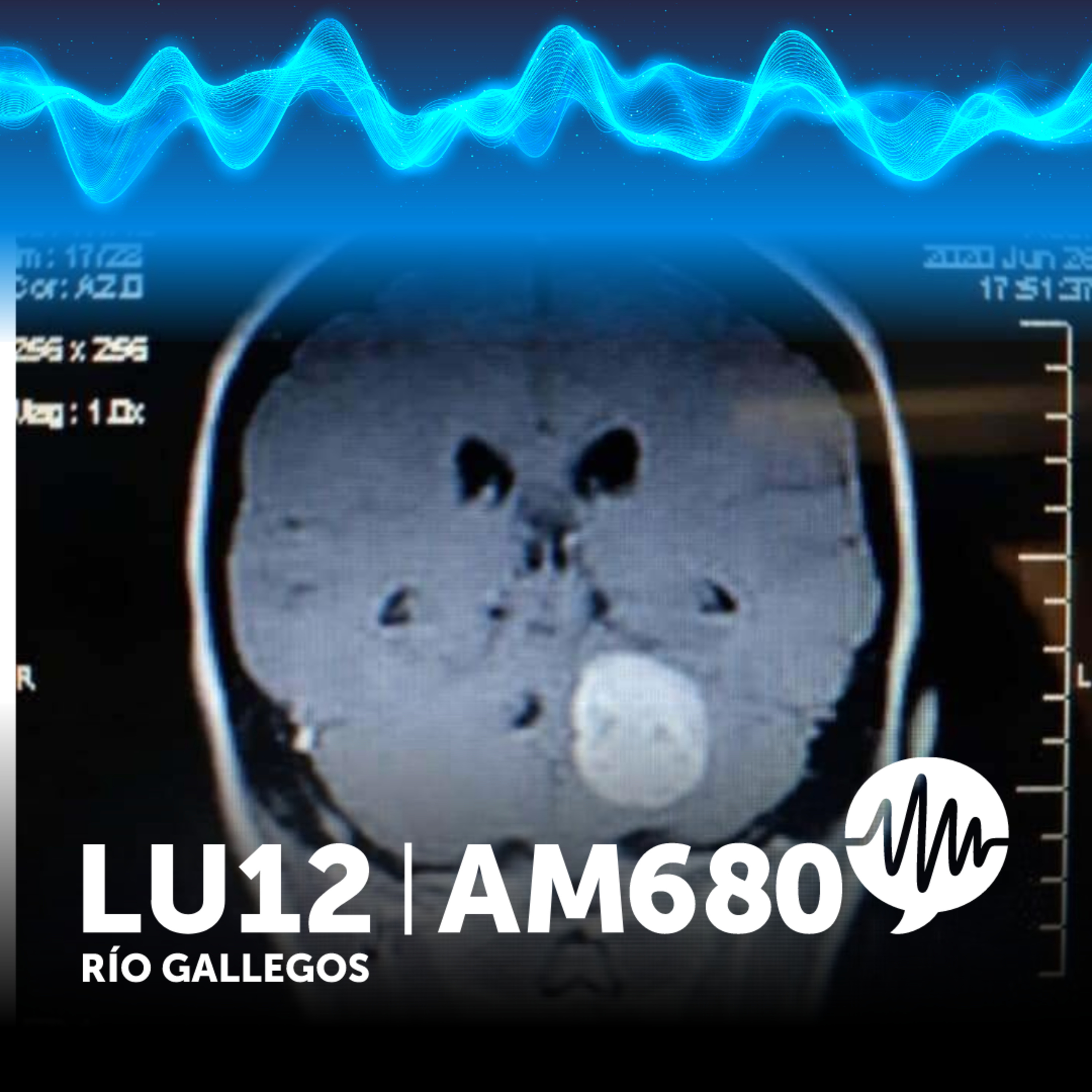 Radio LU12 AM680 de Río Gallegos: Noticias e información de Santa Cruz y la Patagonia