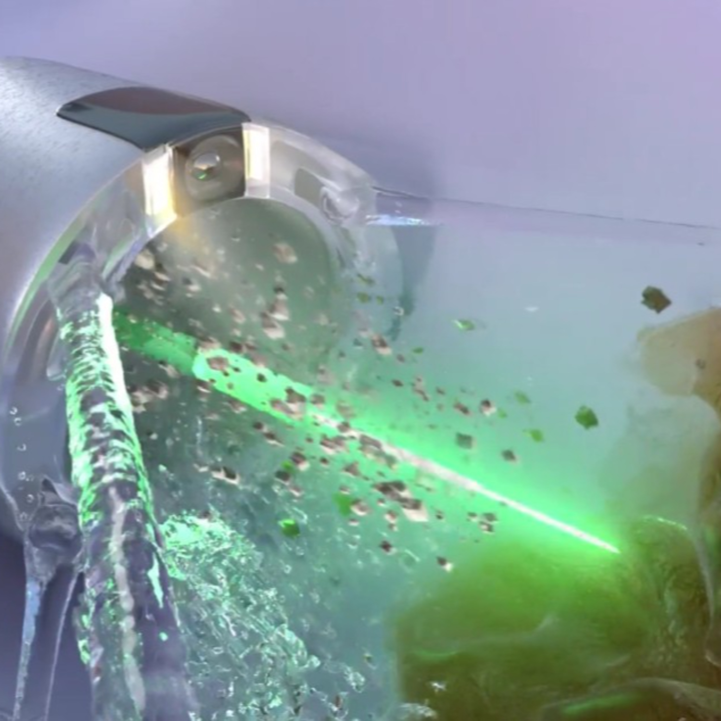 Techstination interview: Newer tech for kidney stones? How CVAC System works. episode artwork