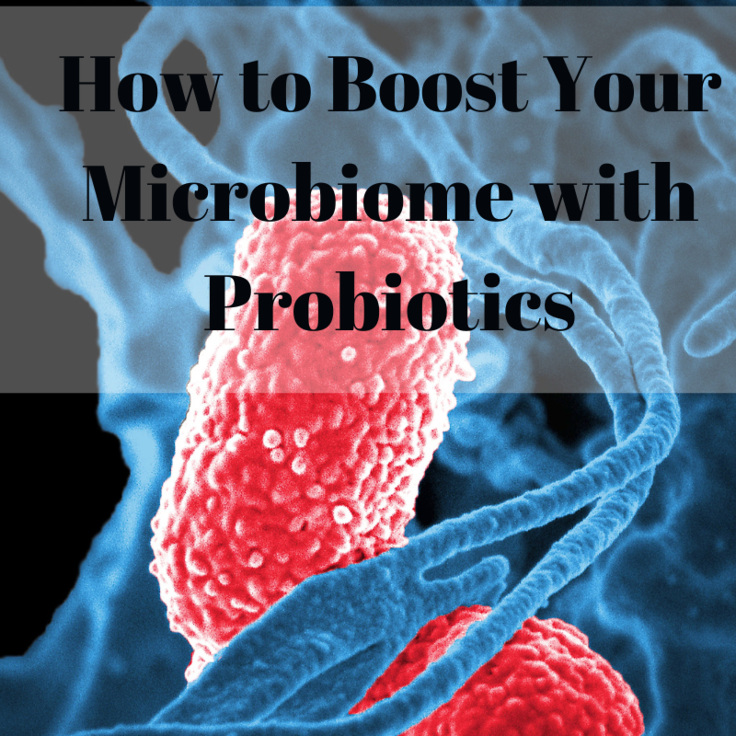How to Boost Your Microbiome with Probiotics episode artwork