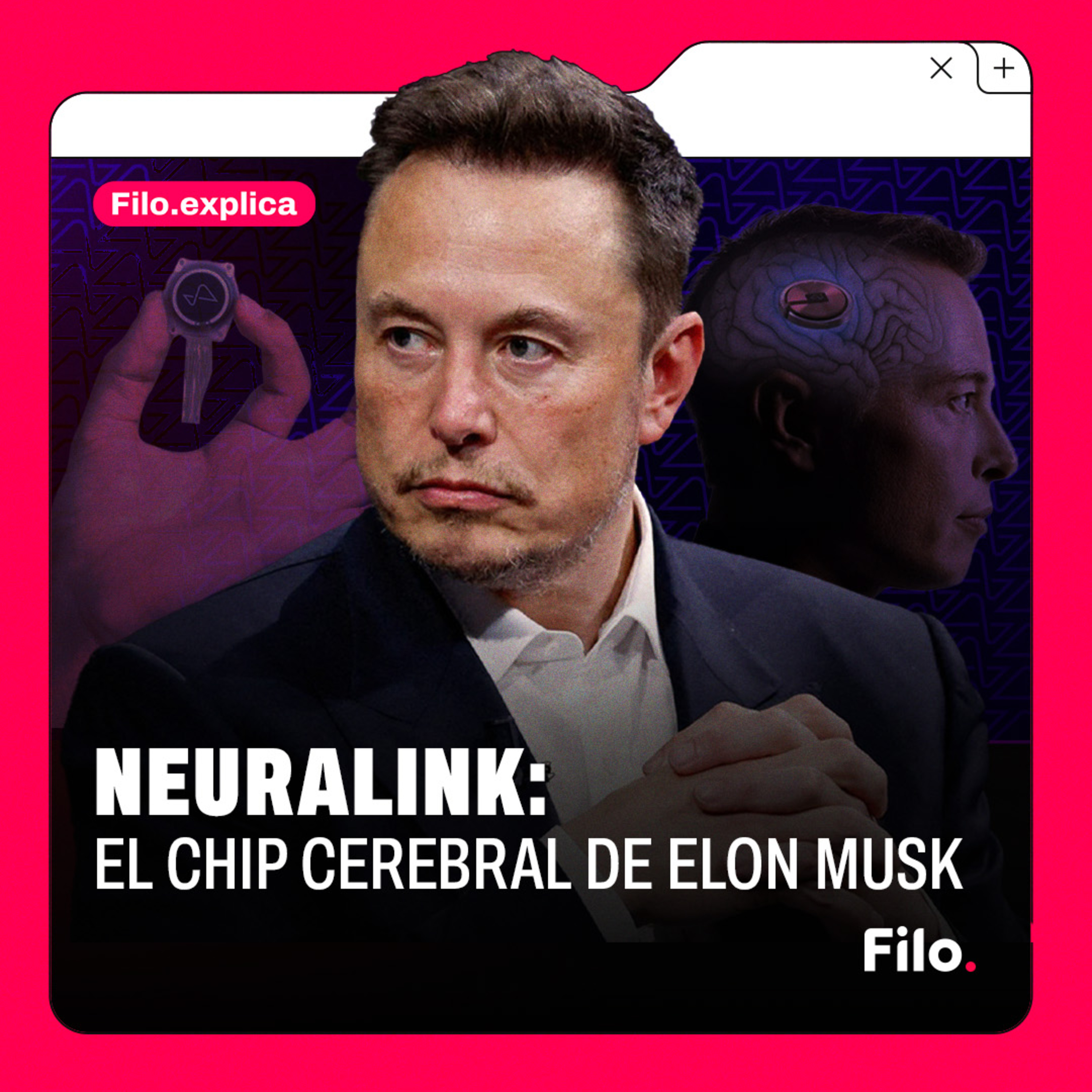 Neuralink: el chip cerebral de Elon Musk | #FiloExplica