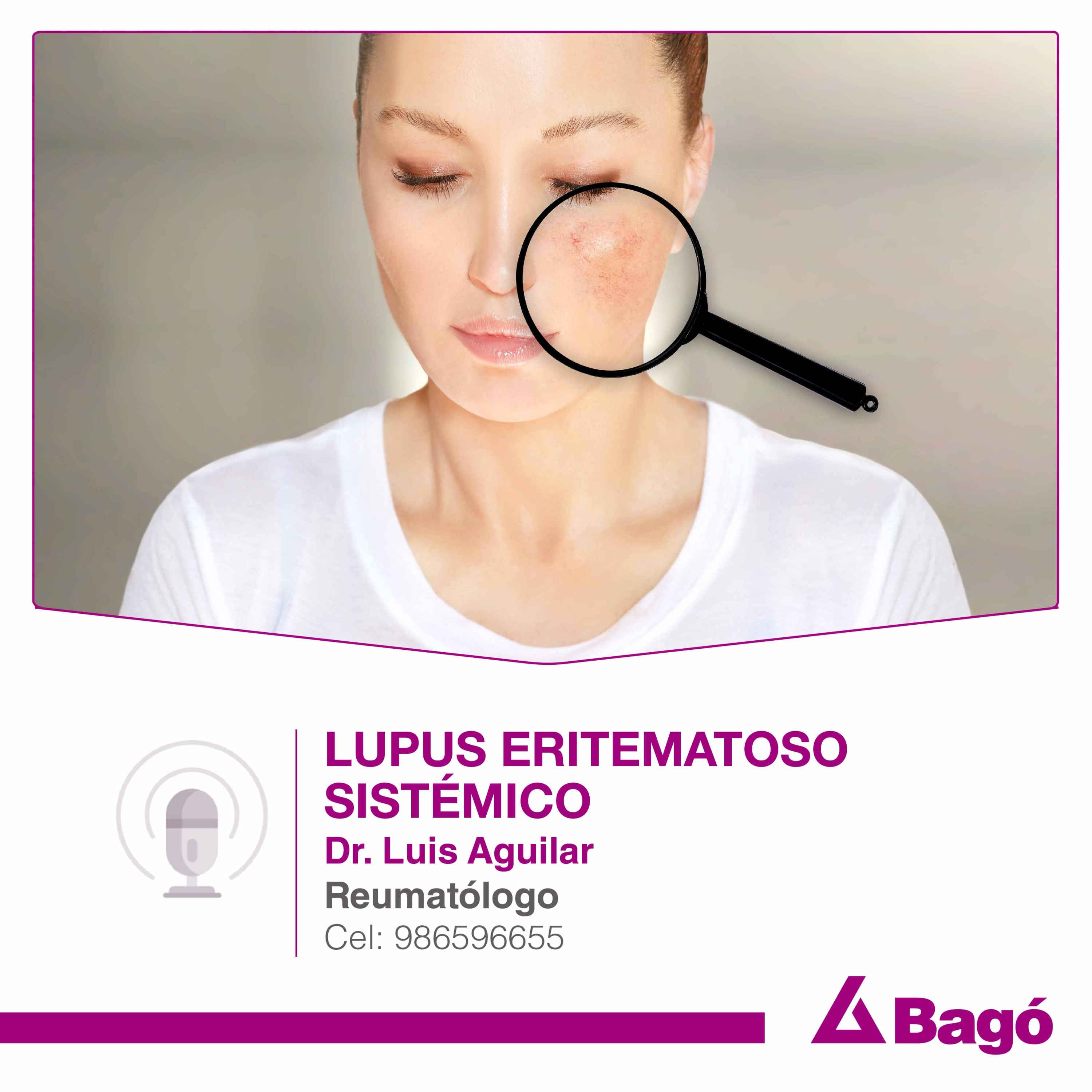 LUPUS ERITEMATOSO SISTÉMICO episode artwork