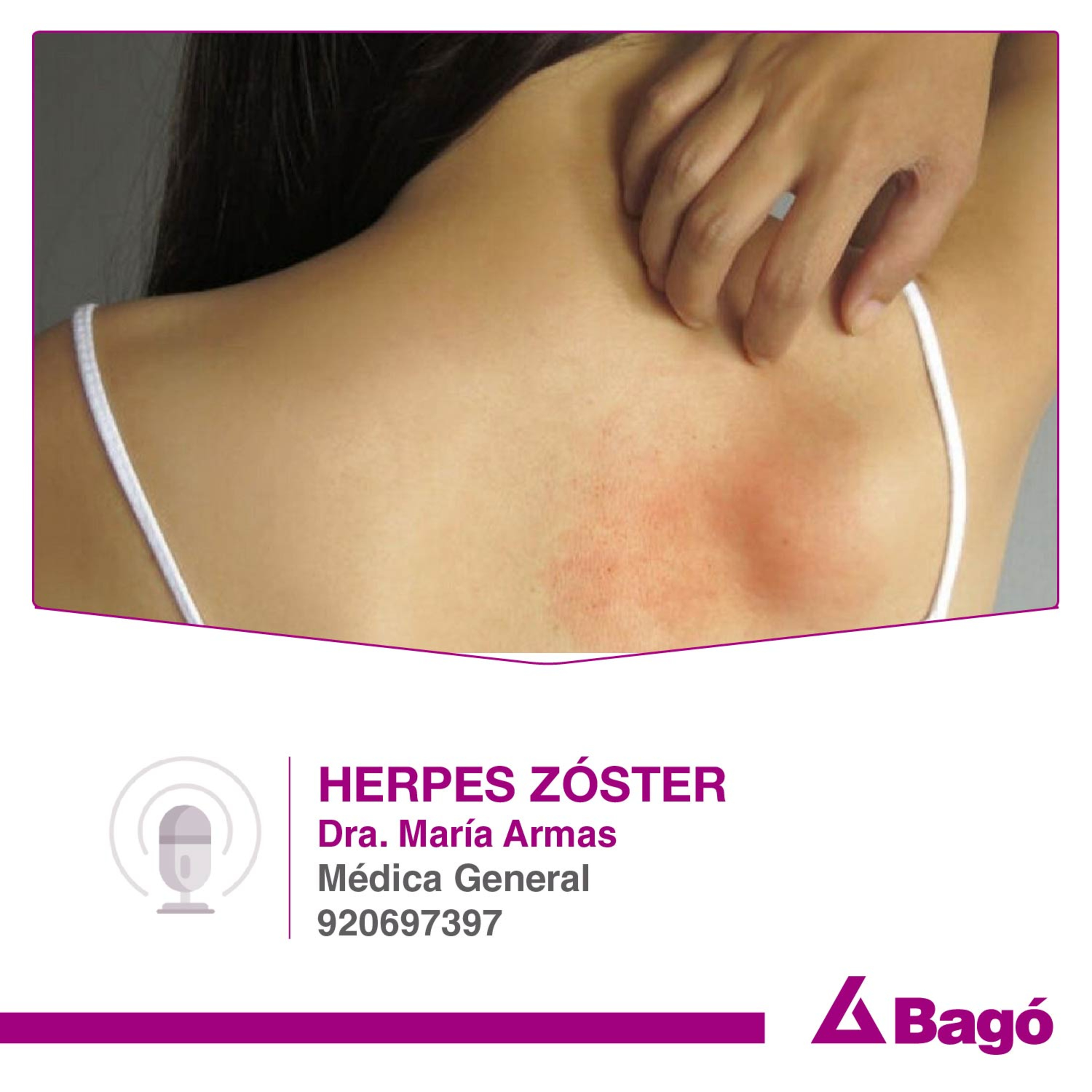 HERPES ZÓSTER episode artwork