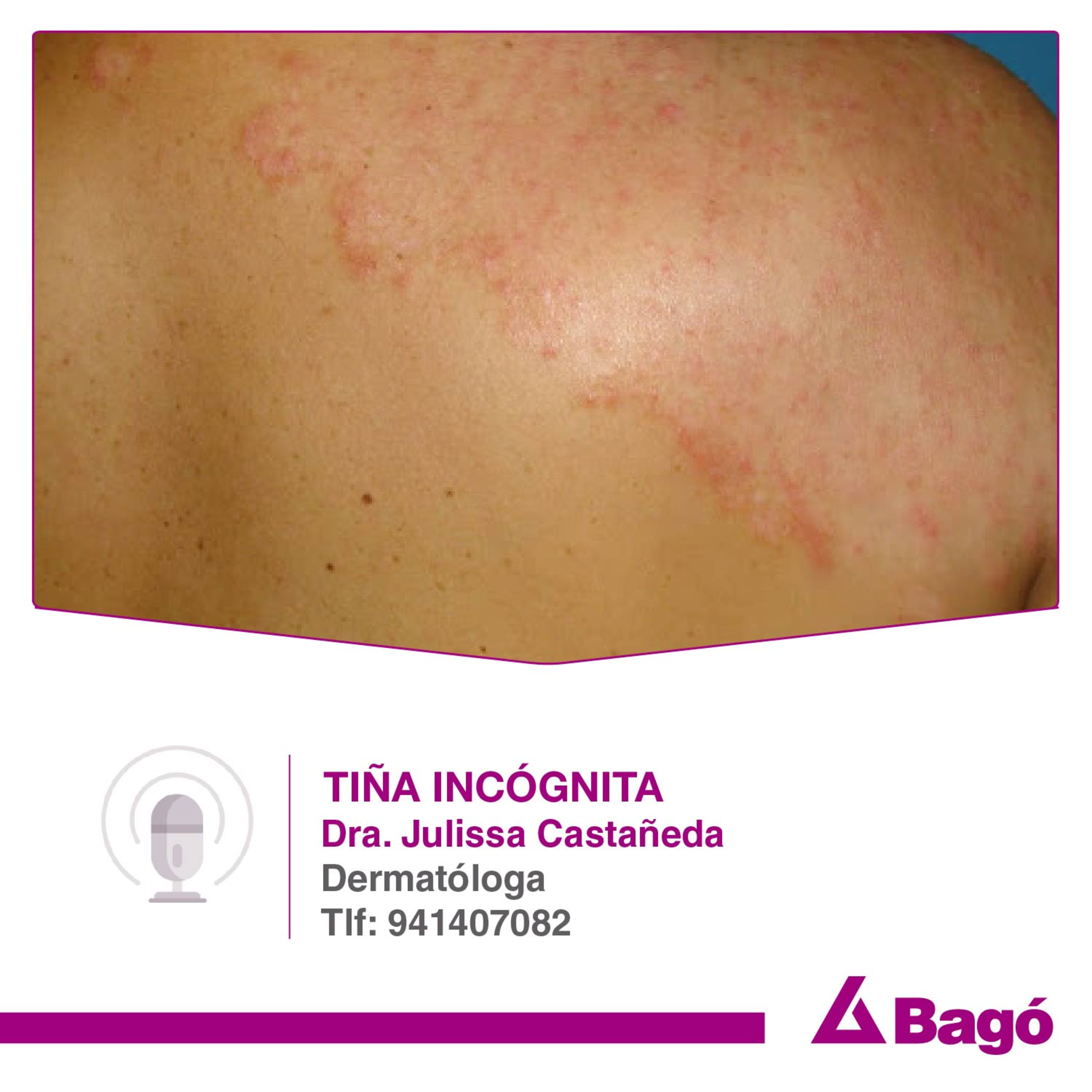 TIÑA INCÓGNITA episode artwork