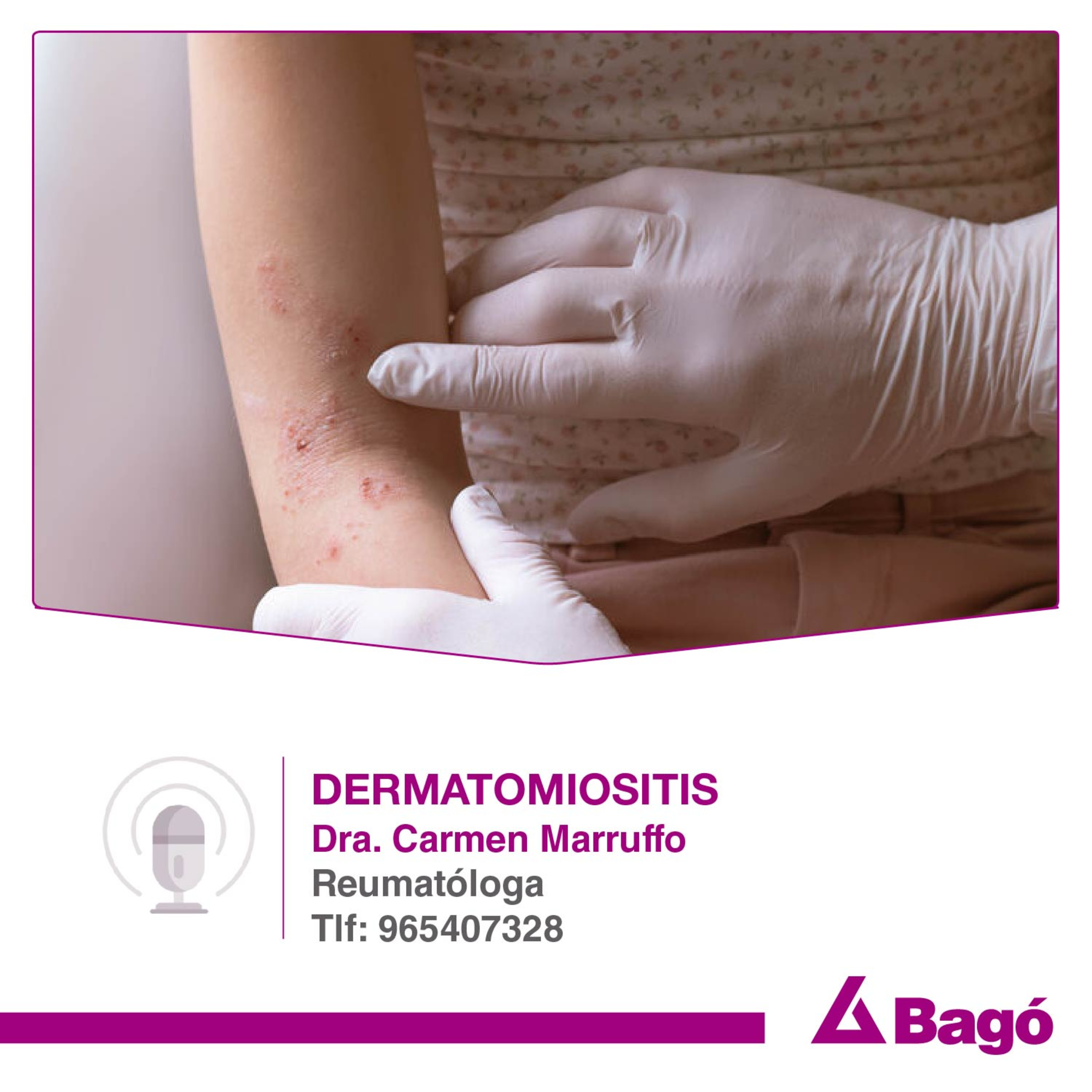 DERMATOMIOSITIS episode artwork