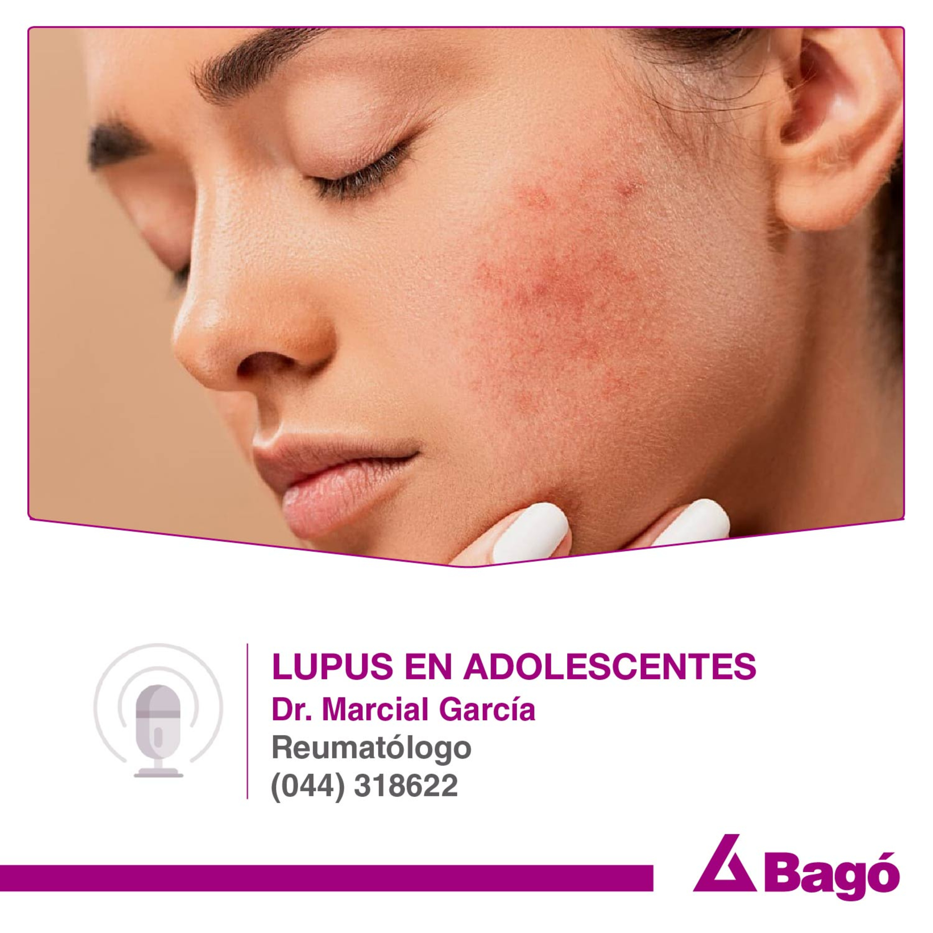 LUPUS EN ADOLESCENTES episode artwork