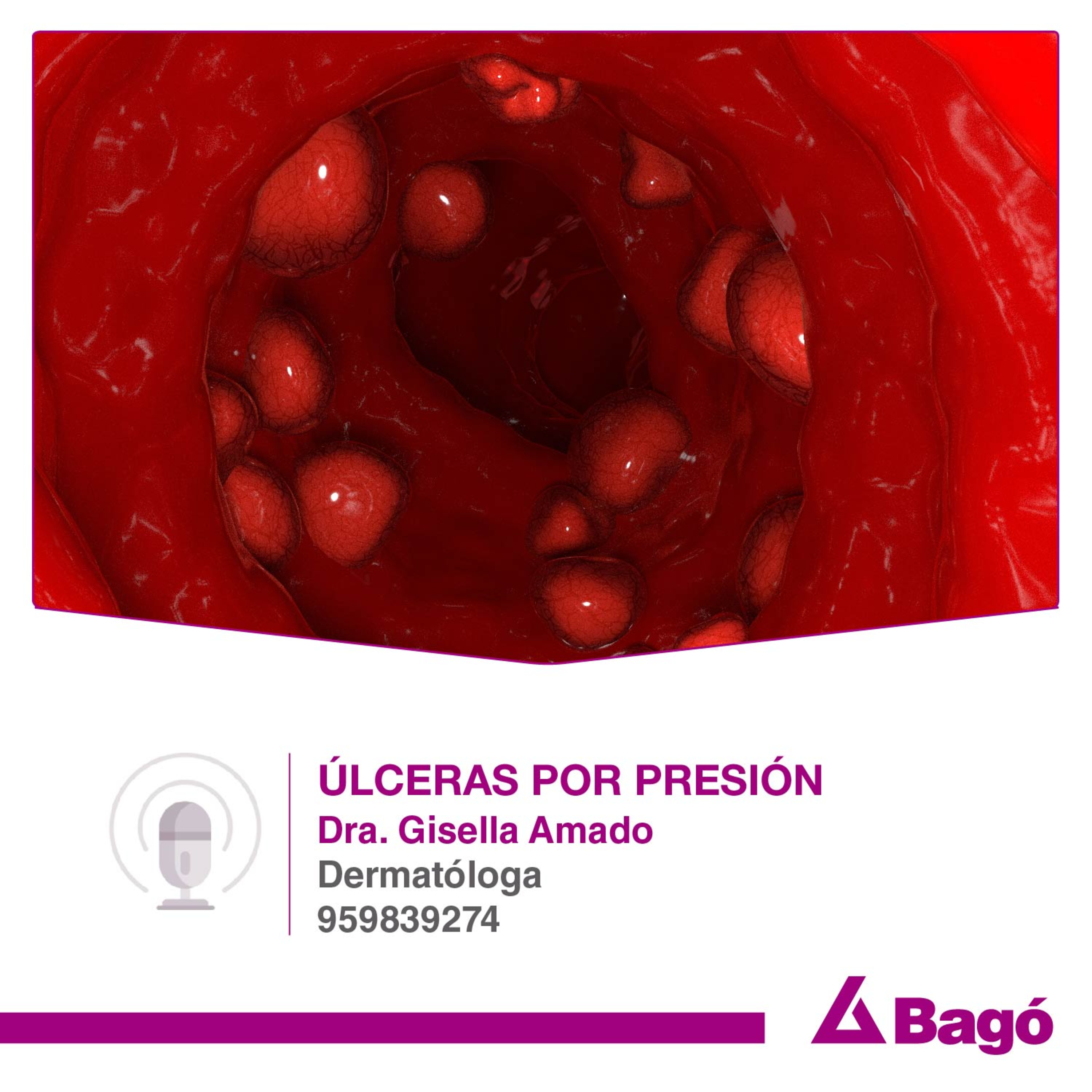 ÚLCERAS POR PRESIÓN  episode artwork