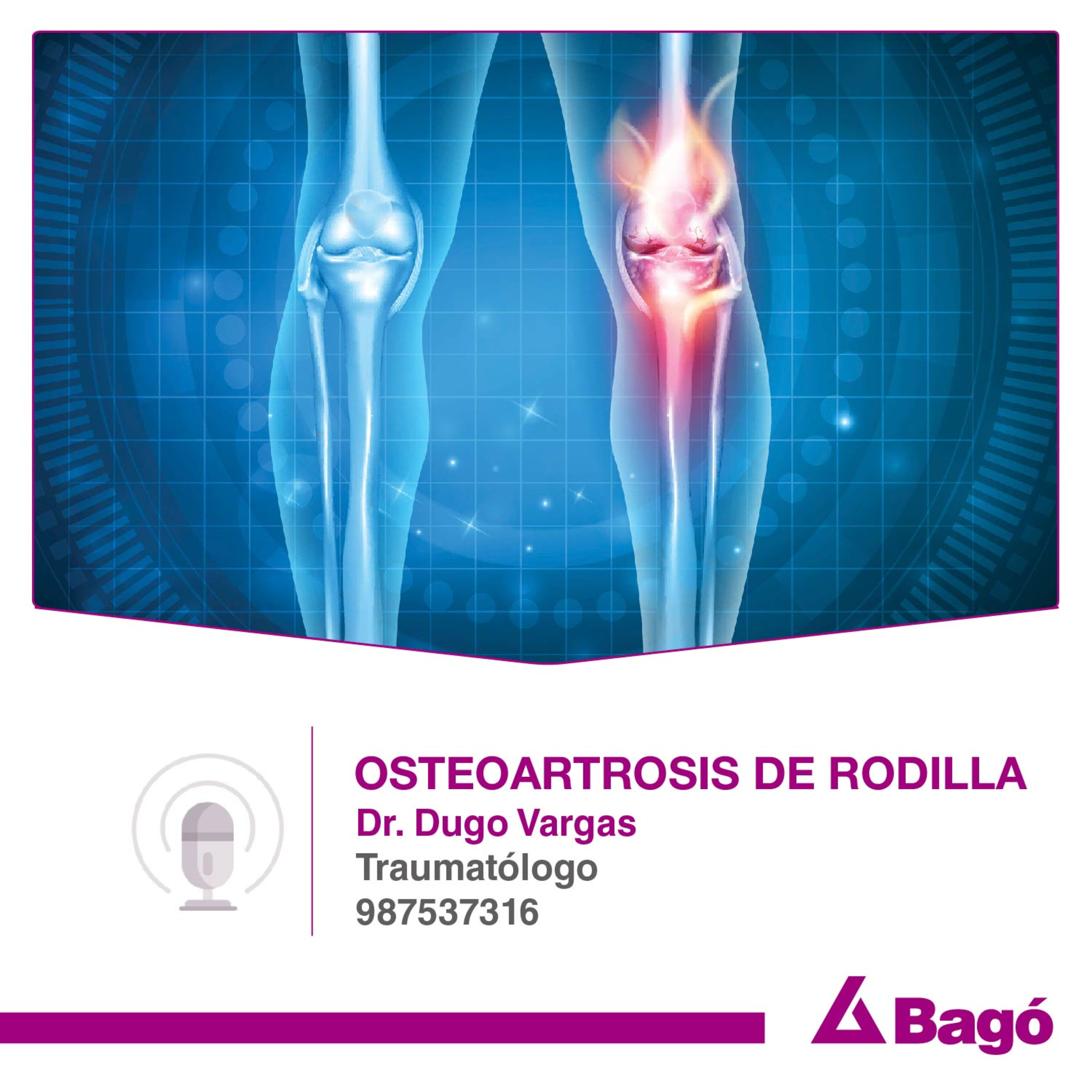 OSTEOARTROSIS DE RODILLA episode artwork