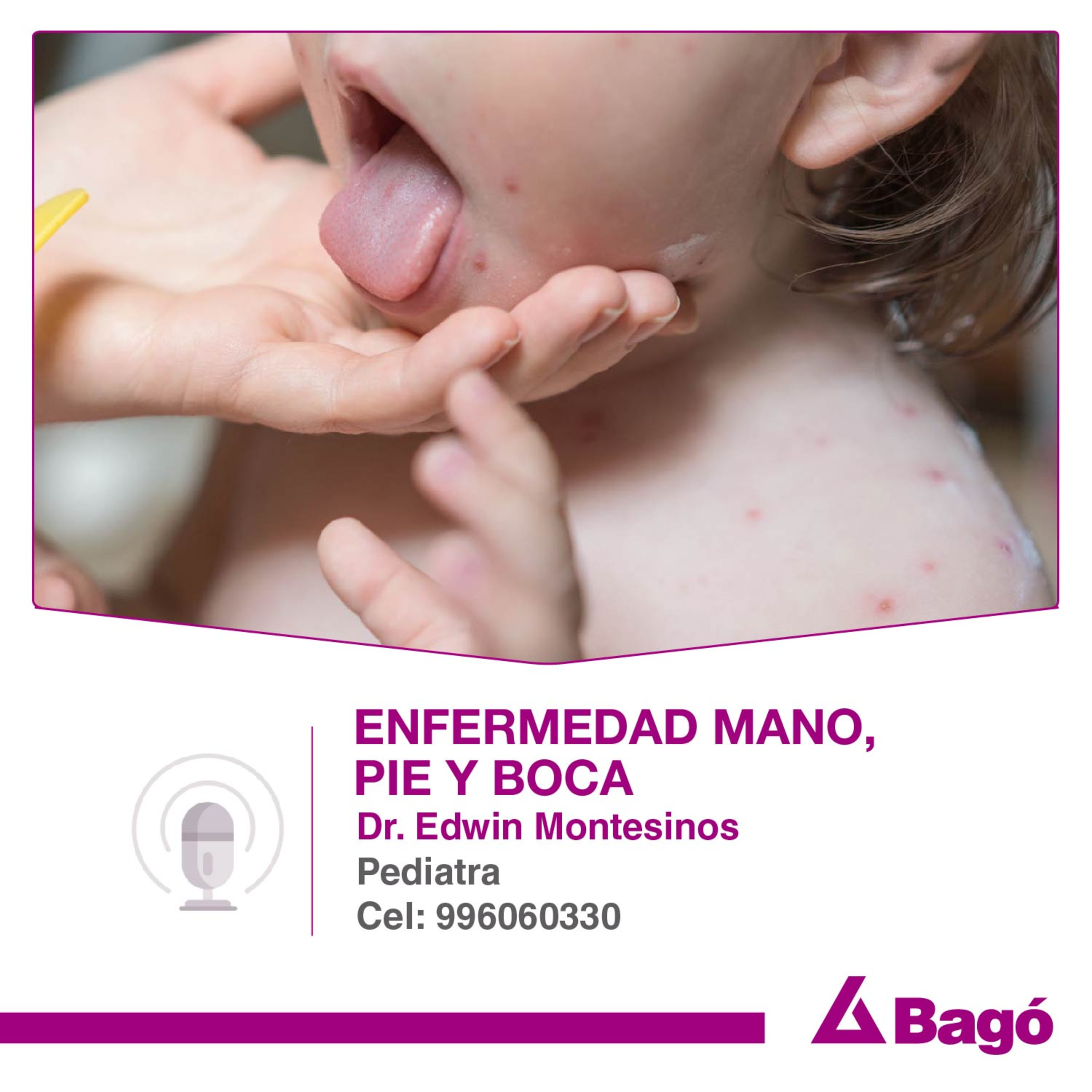 ENFERMEDAD MANO, PIE Y BOCA episode artwork