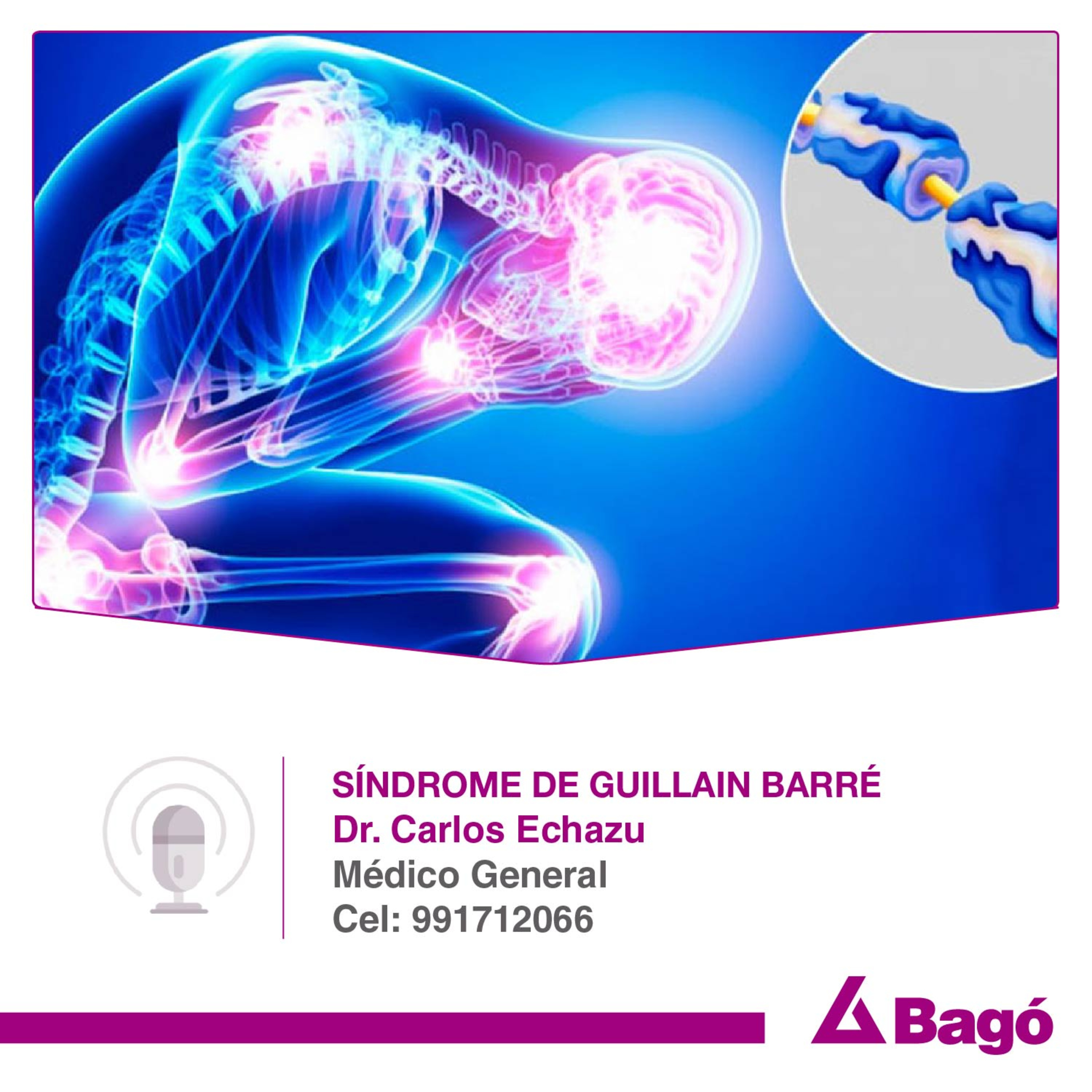 SÍNDROME DE GUILLAIN-BARRÉ episode artwork