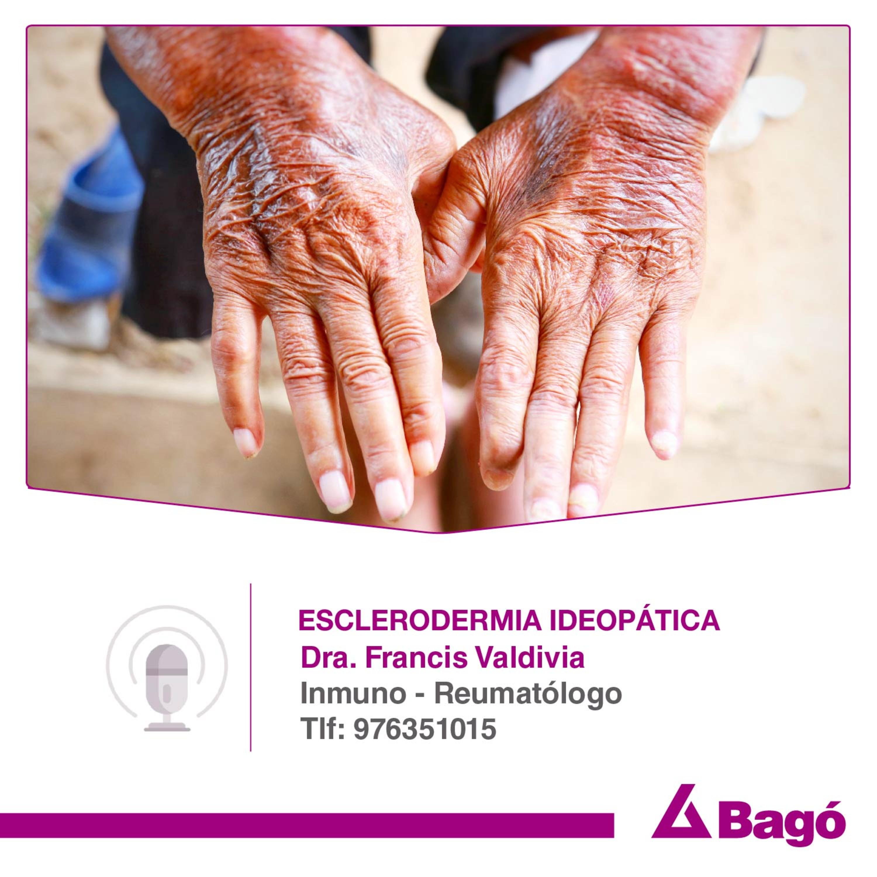 ESCLERODERMIA IDEOPÁTICA episode artwork