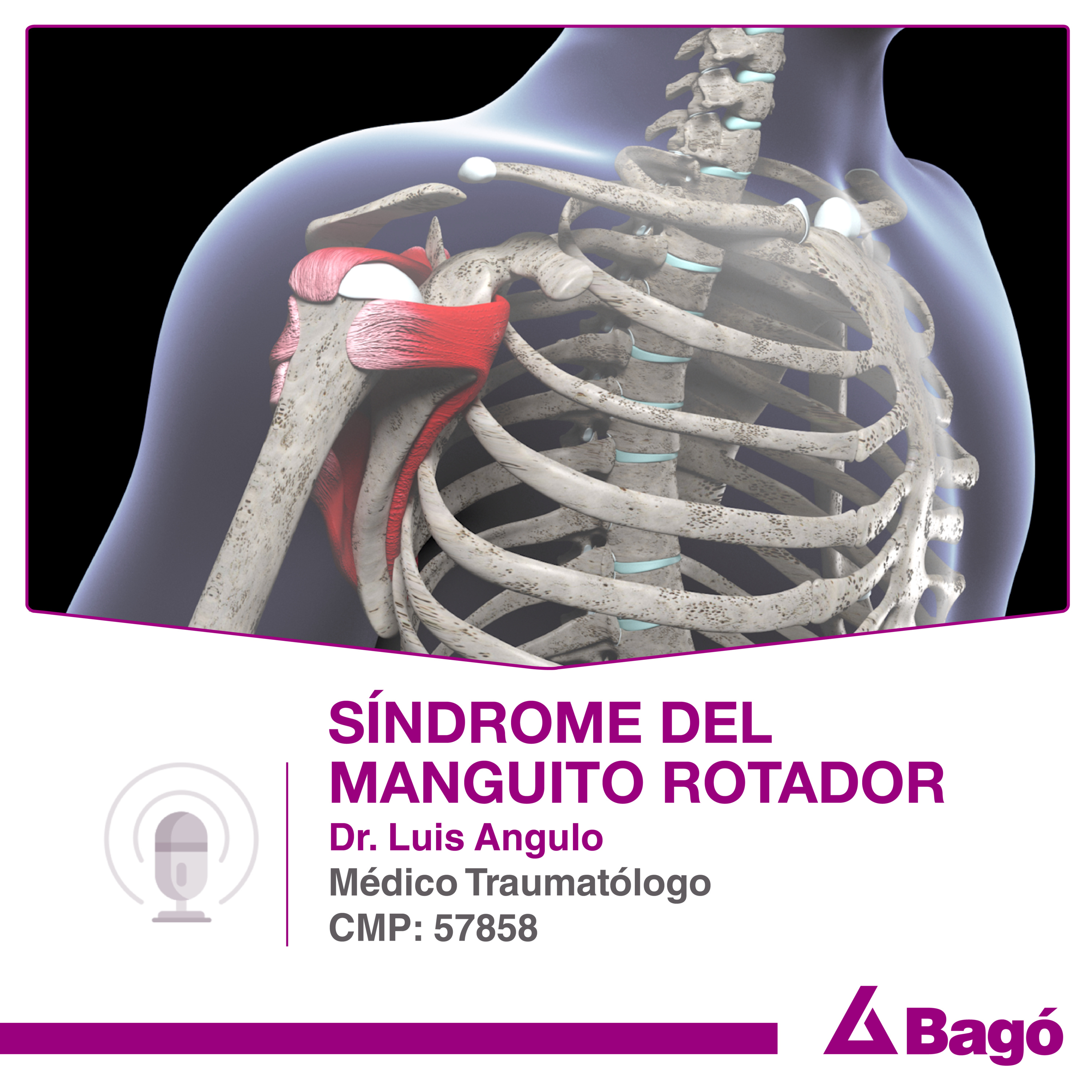 SÍNDROME DEL MANGUITO ROTADOR episode artwork