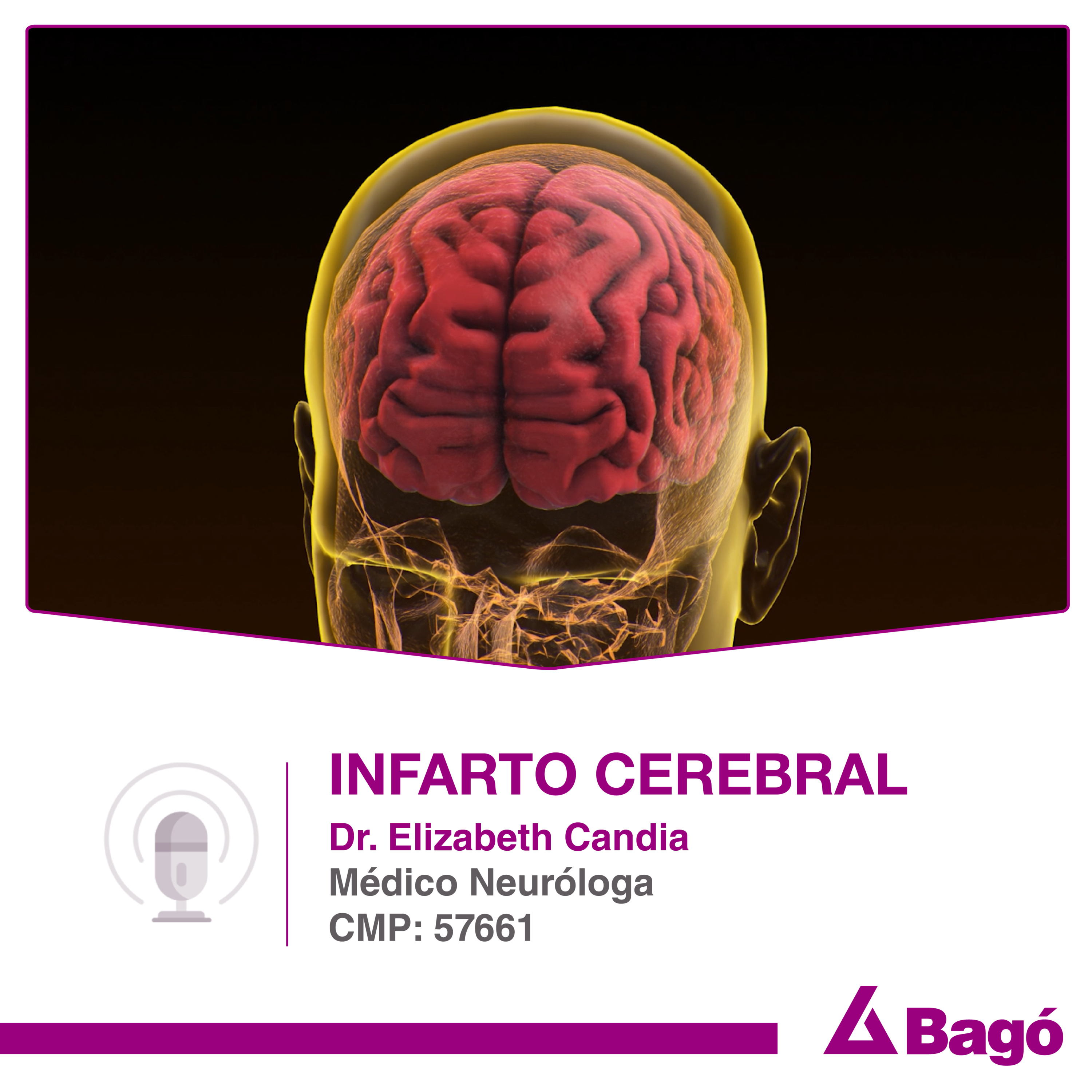 INFARTO CEREBRAL episode artwork