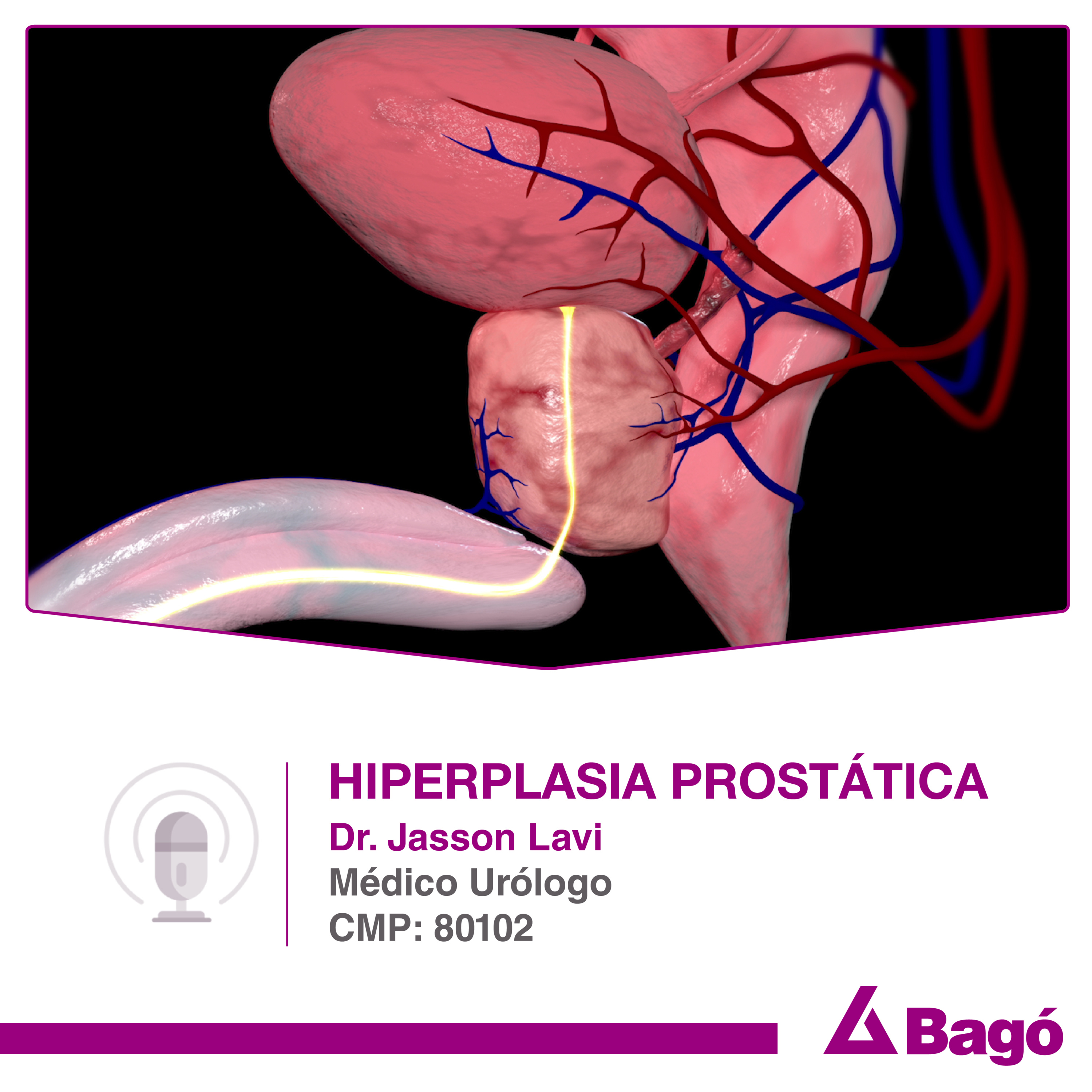 HIPERPLASIA PROSTÁTICA episode artwork