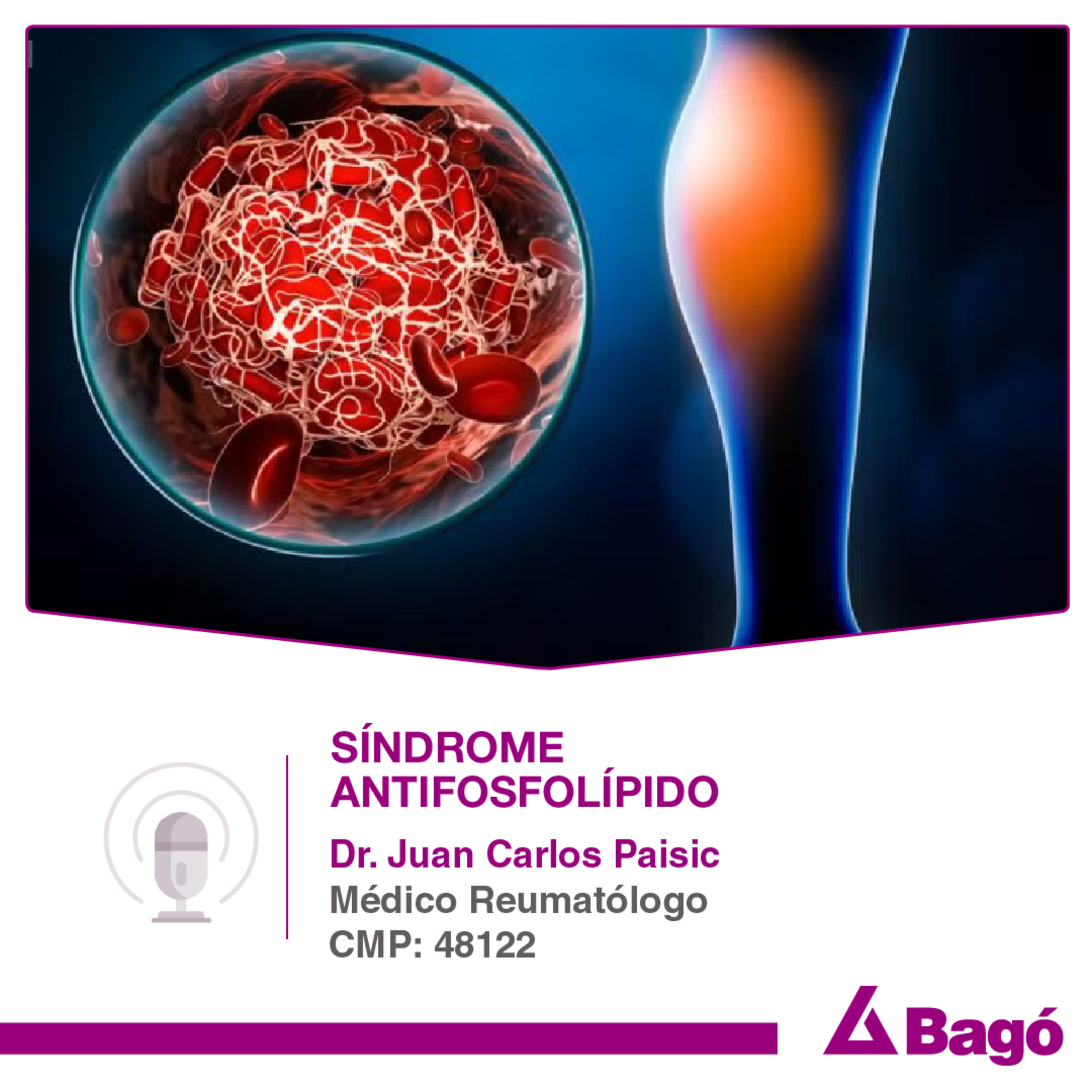 Síndrome antifosfolípido: Factores de riesgo y prevención  episode artwork