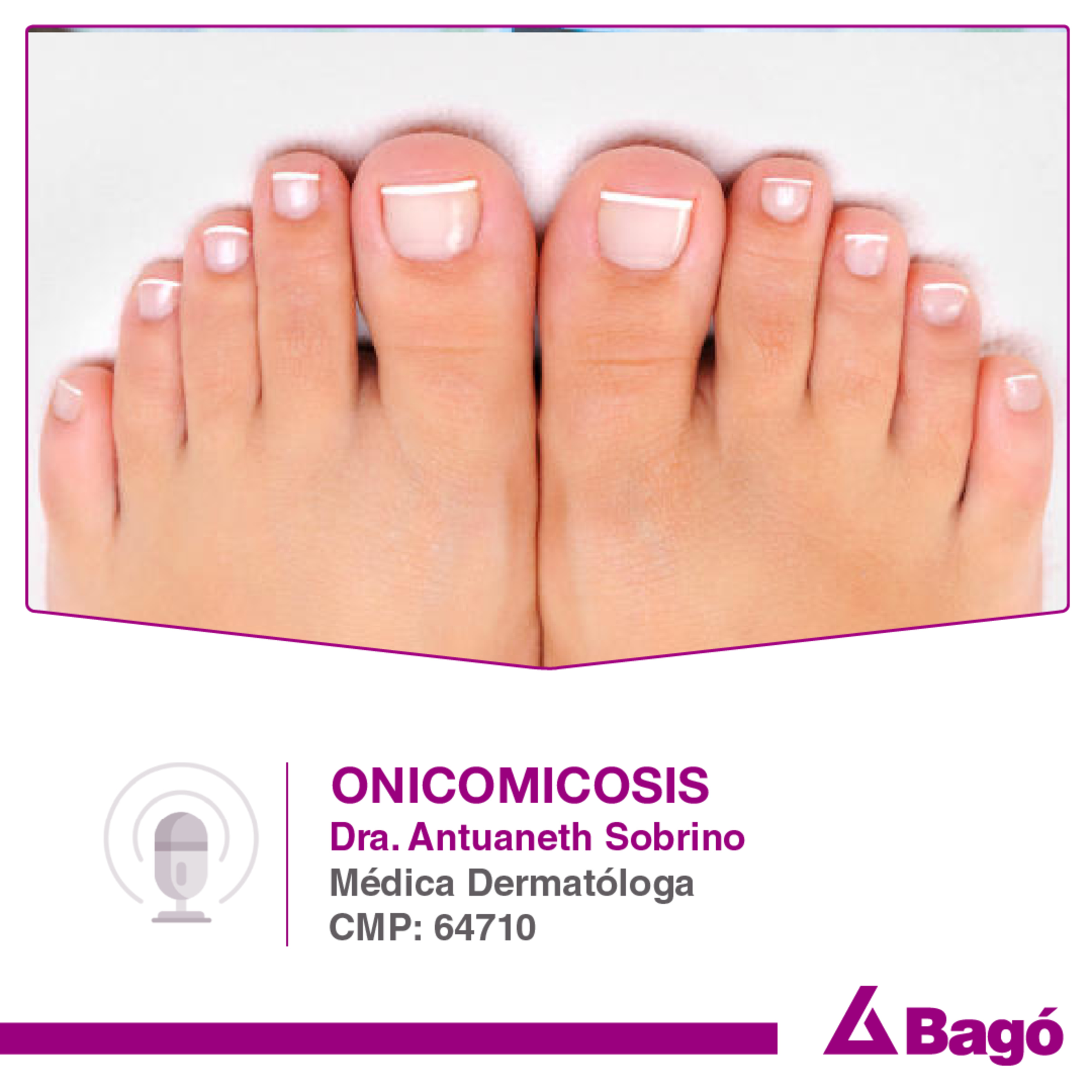 ONICOMICOSIS: CUIDA LAS UÑAS DE TUS PIES episode artwork