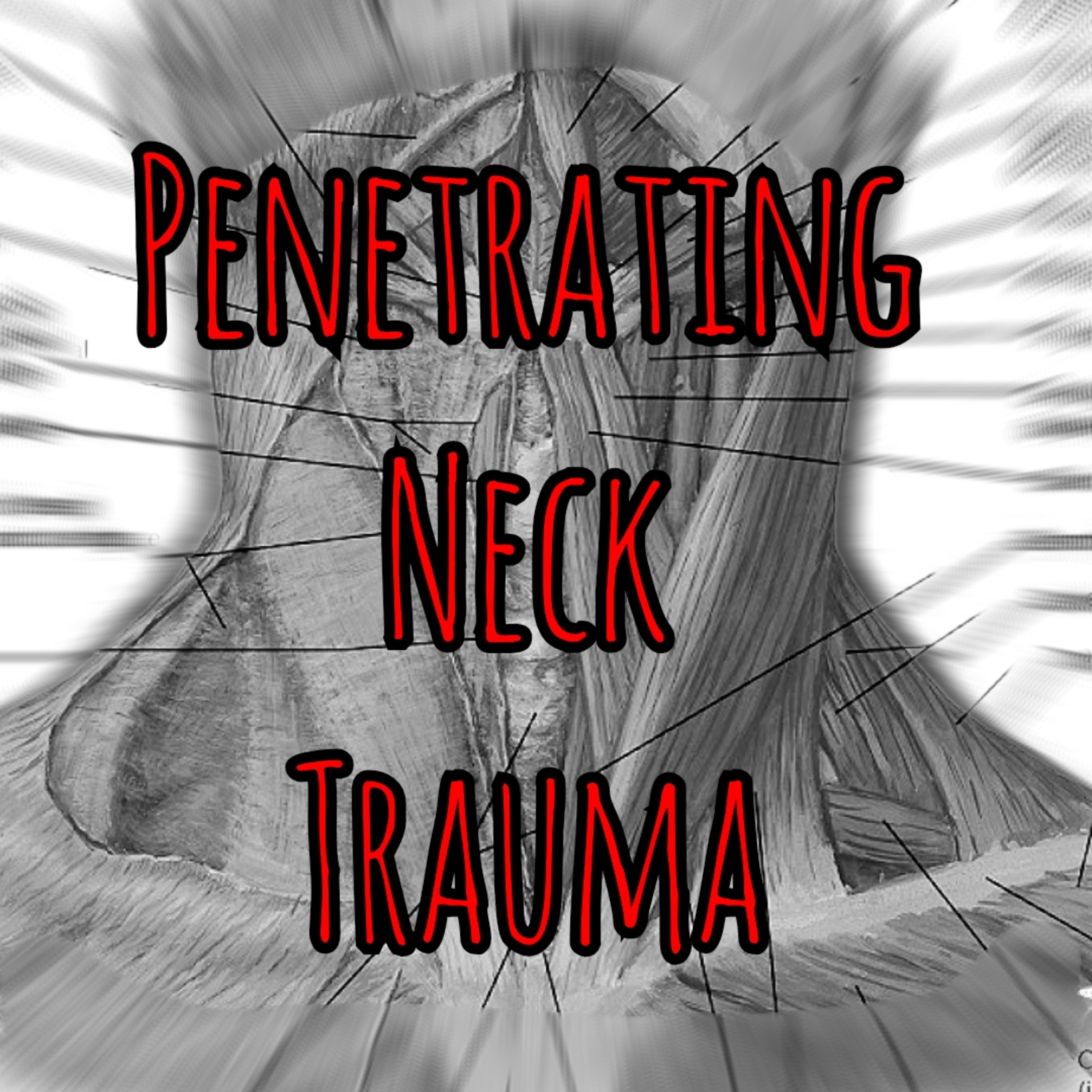 #9 of 2025 Top Ten: Penetrating Neck Trauma