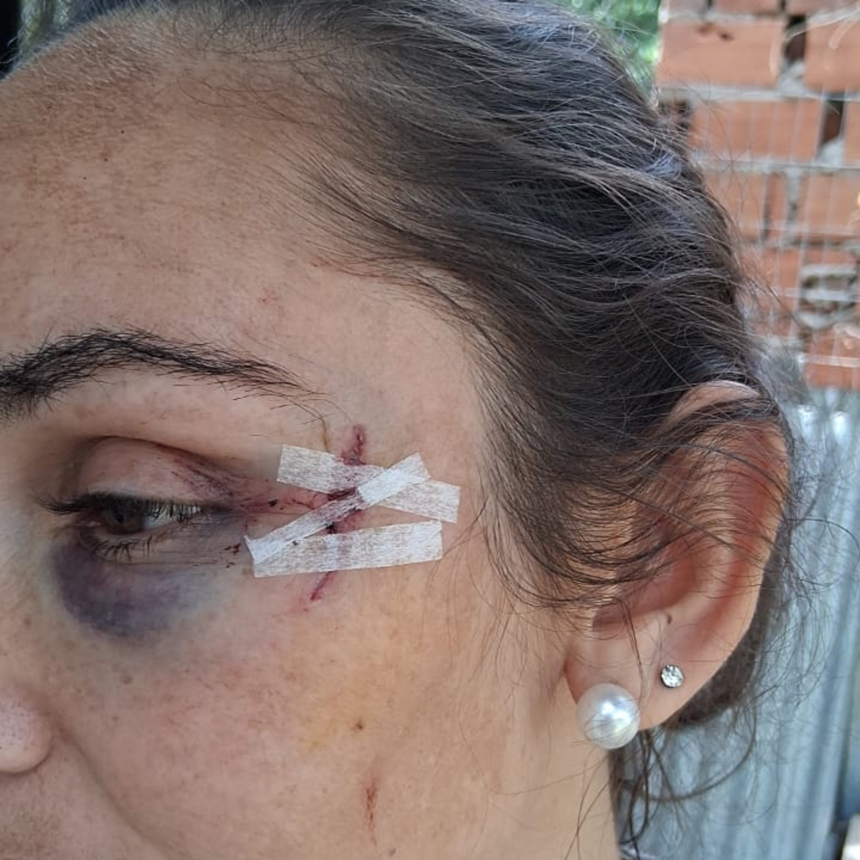 Ataque a balazos en San José del Rincón: hirieron a la hermana del intendente episode artwork