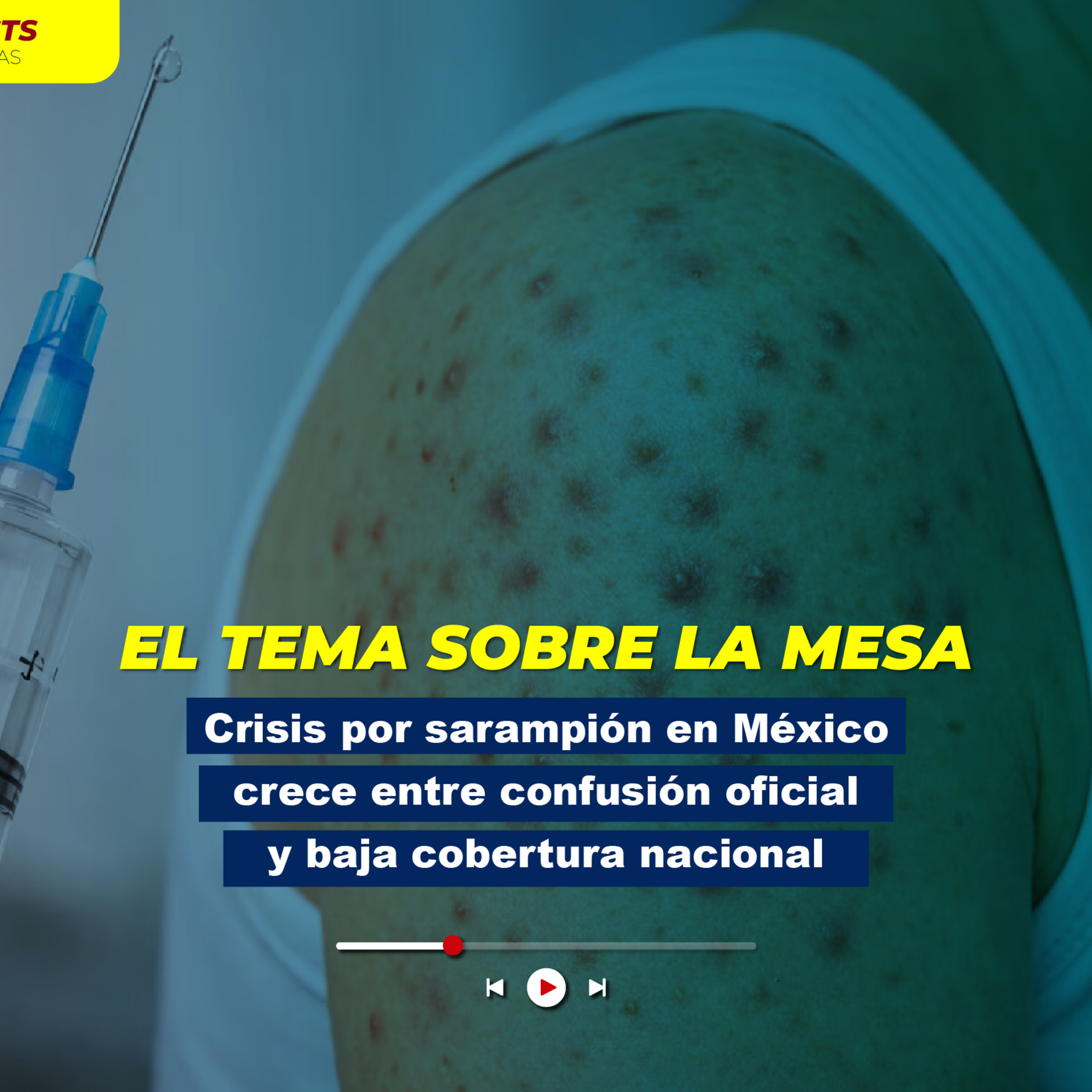 Crisis por sarampión en México crece entre confusión oficial y baja cobertura nacional episode artwork