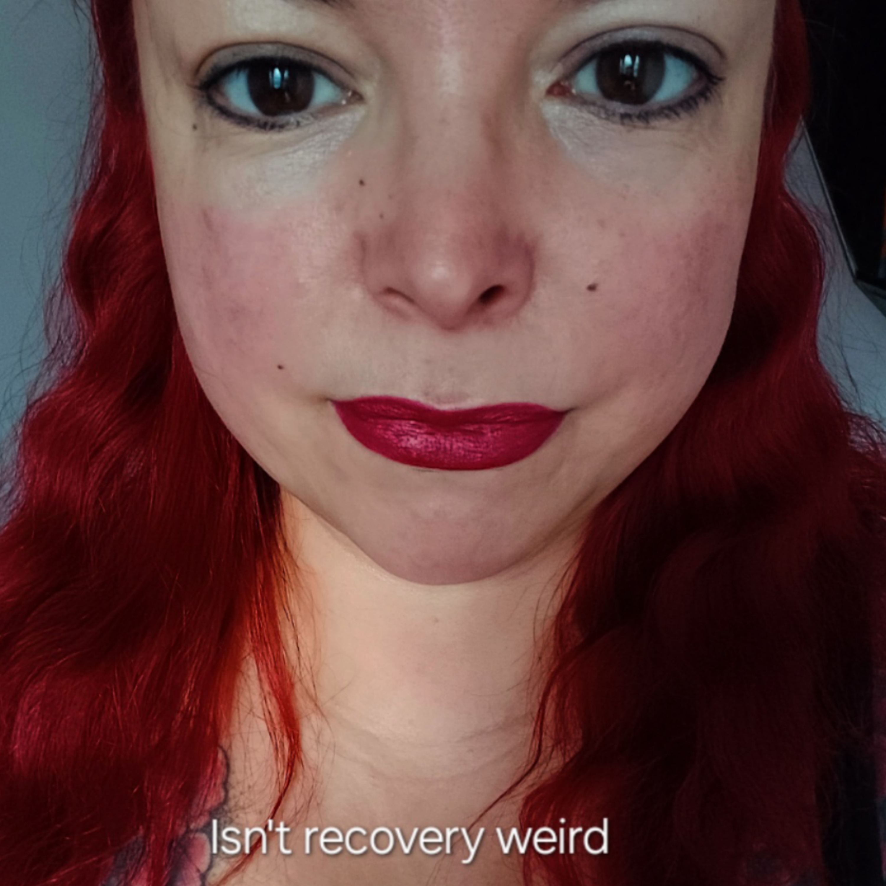 Isn't recovery weird episode artwork