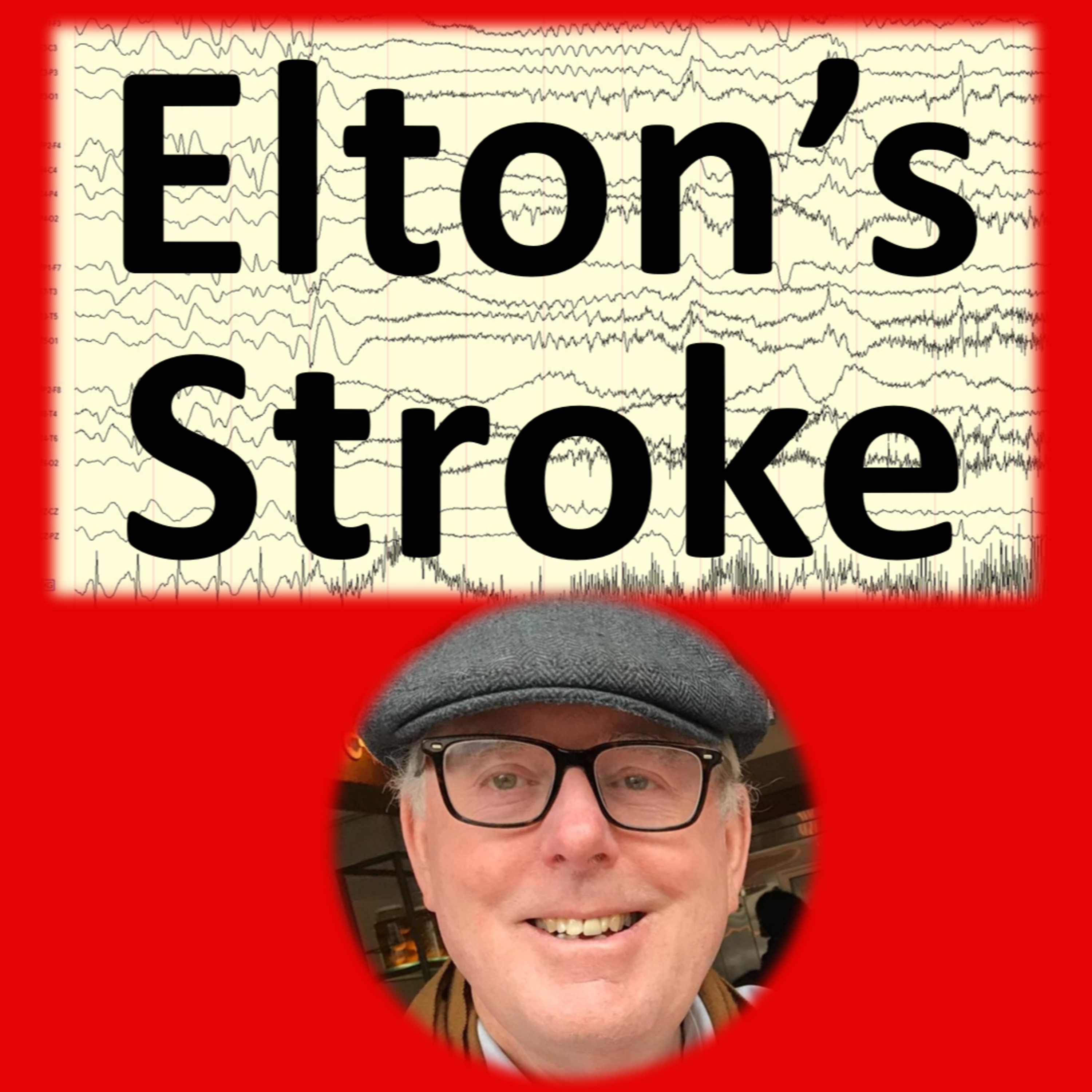 55. Elton's Stoke episode artwork