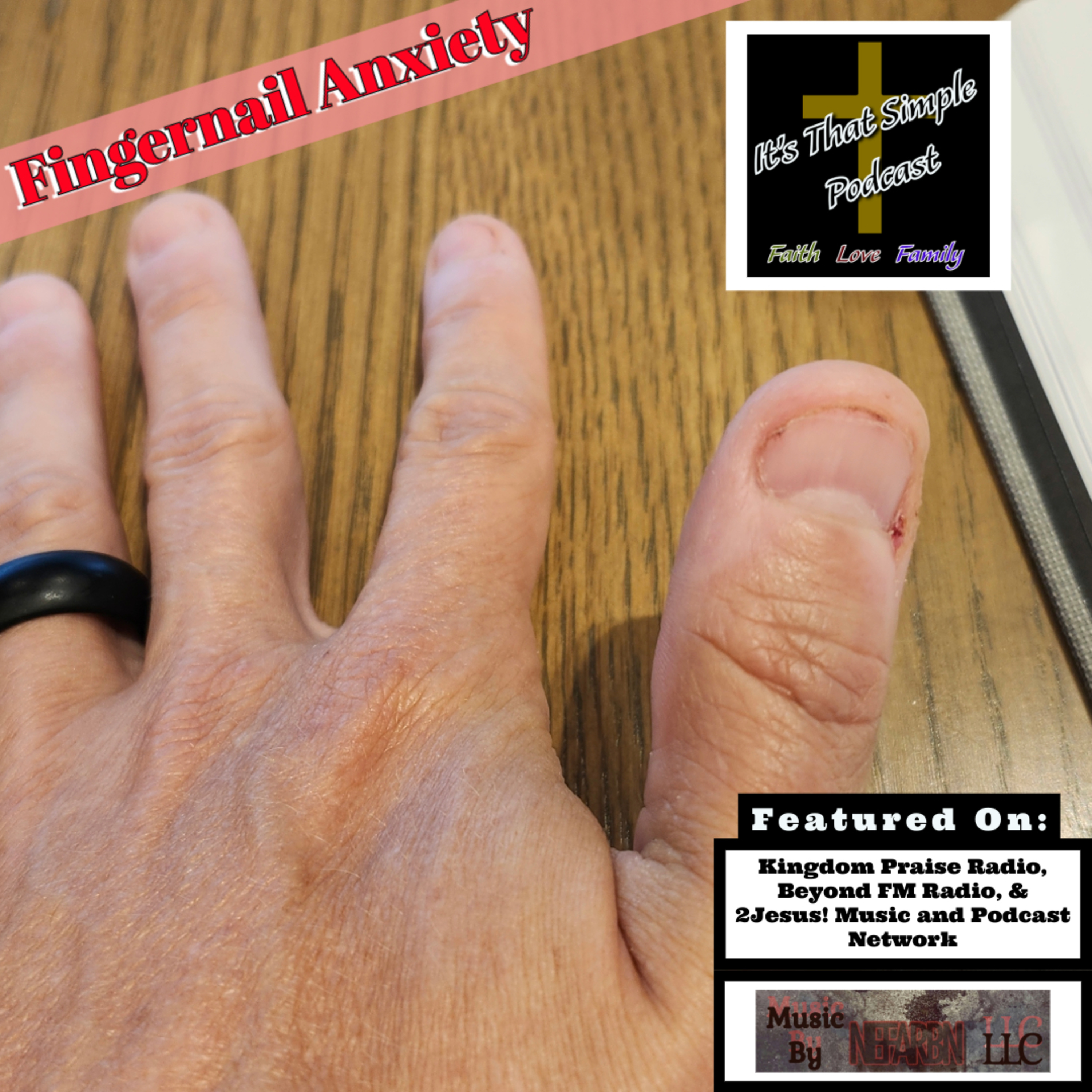 Fingernail Anxiety